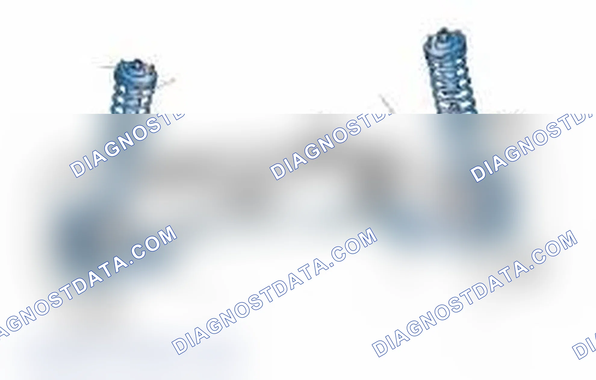 Scheme 25: Typical Front Suspension & Steering Components