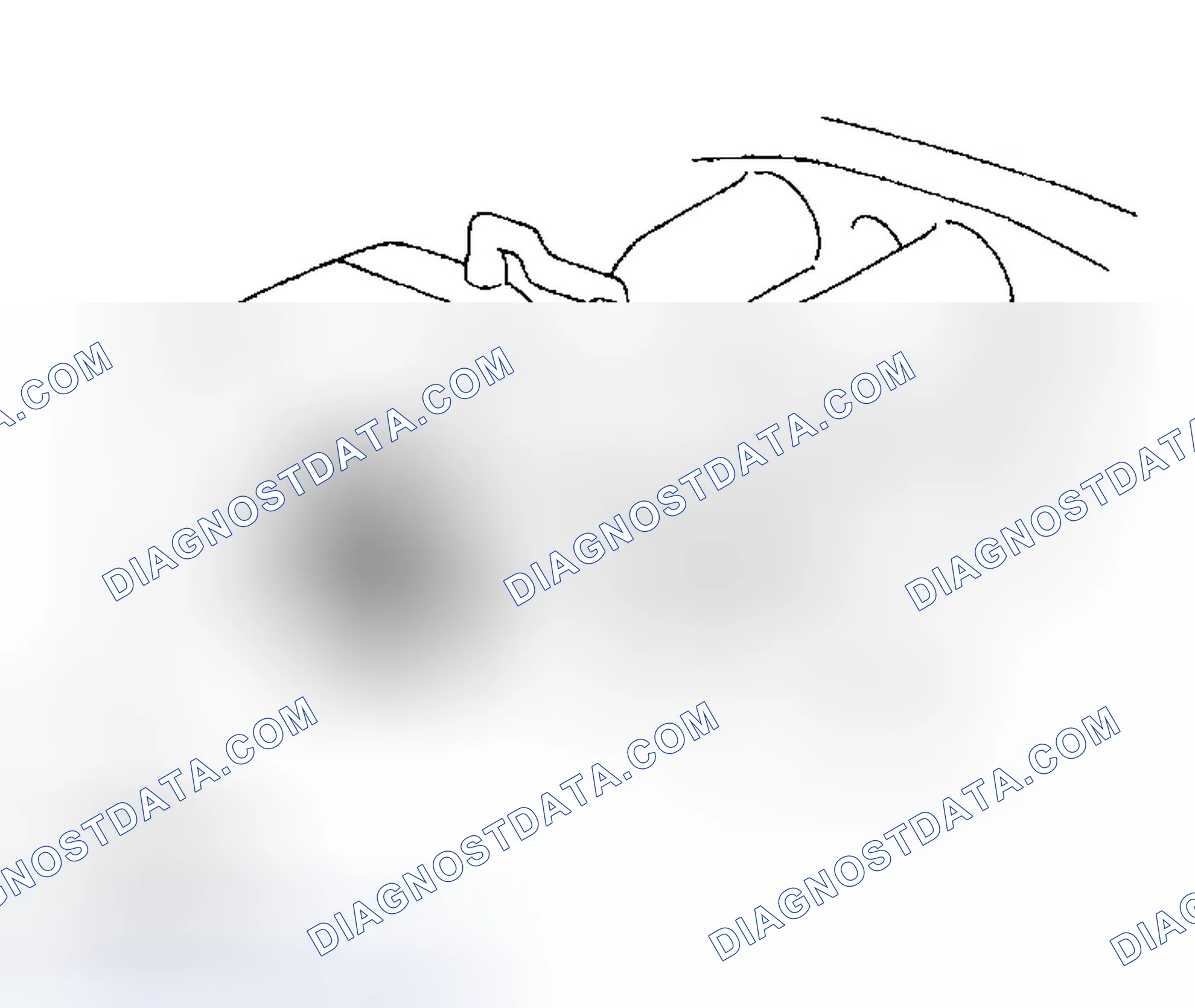 Scheme 51: REMOVAL AND INSTALLATION OF ENGINE INTAKE PARTS