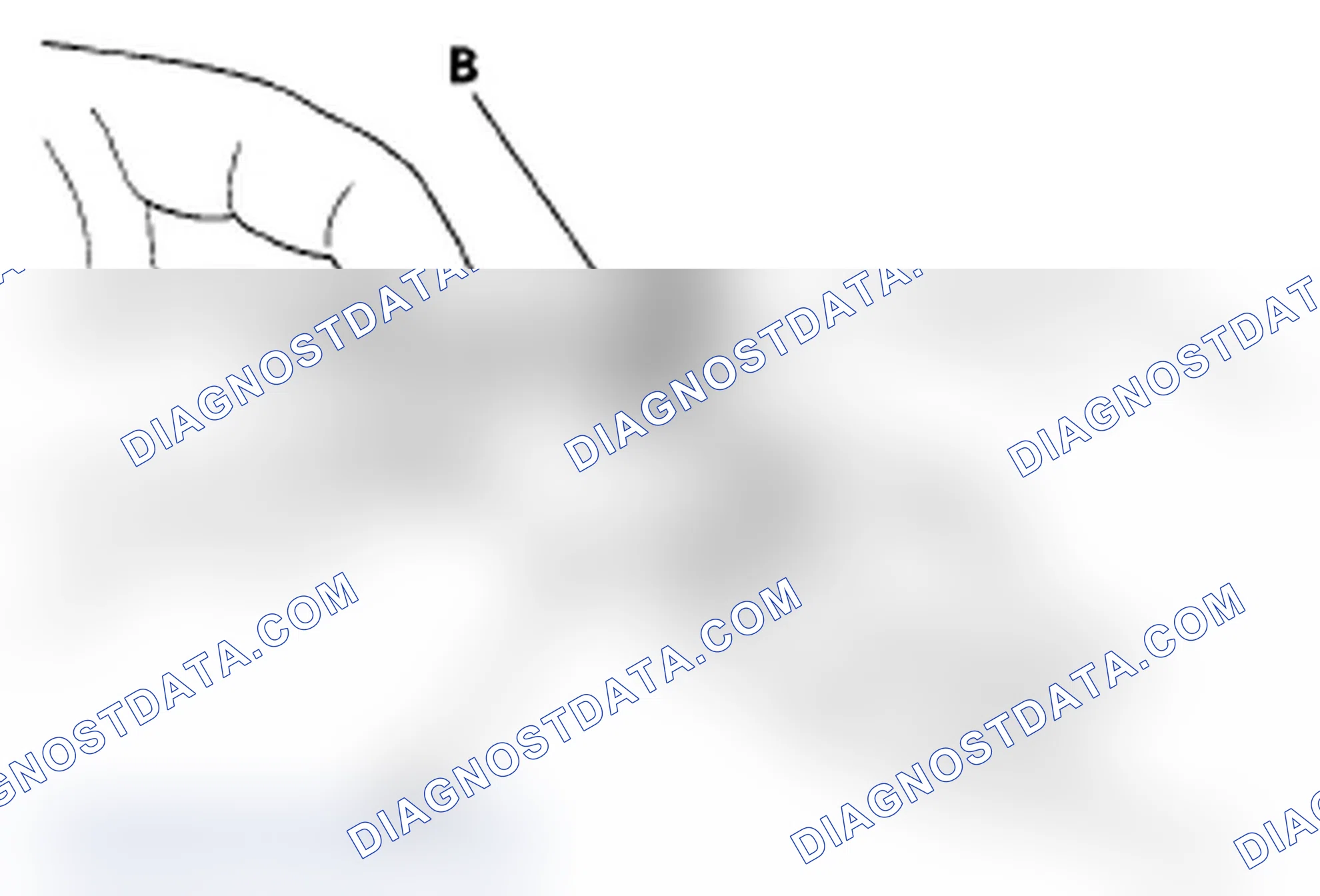 Scheme 18: Disconnecting