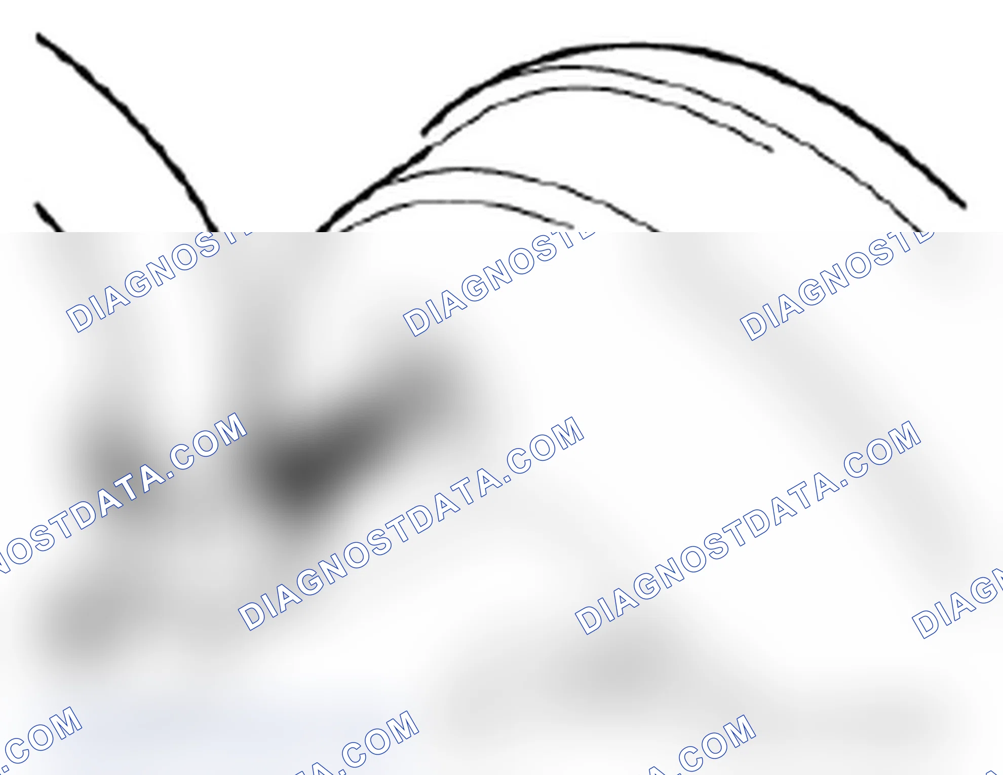 Scheme 131: 11 13 000 Removing and installing, sealing or replacing oil pan (M44)