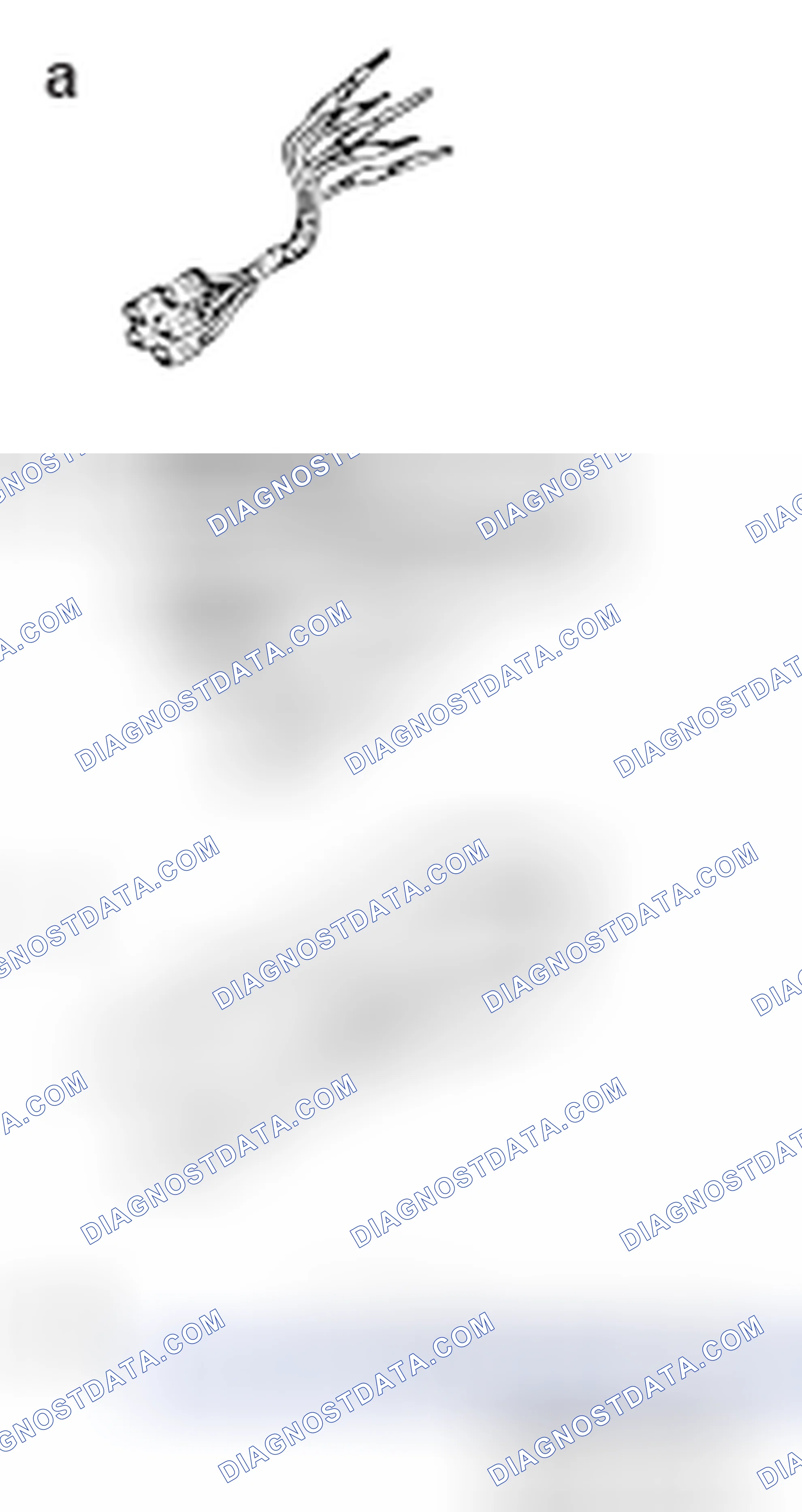 Scheme 221: SPECIAL TOOLS