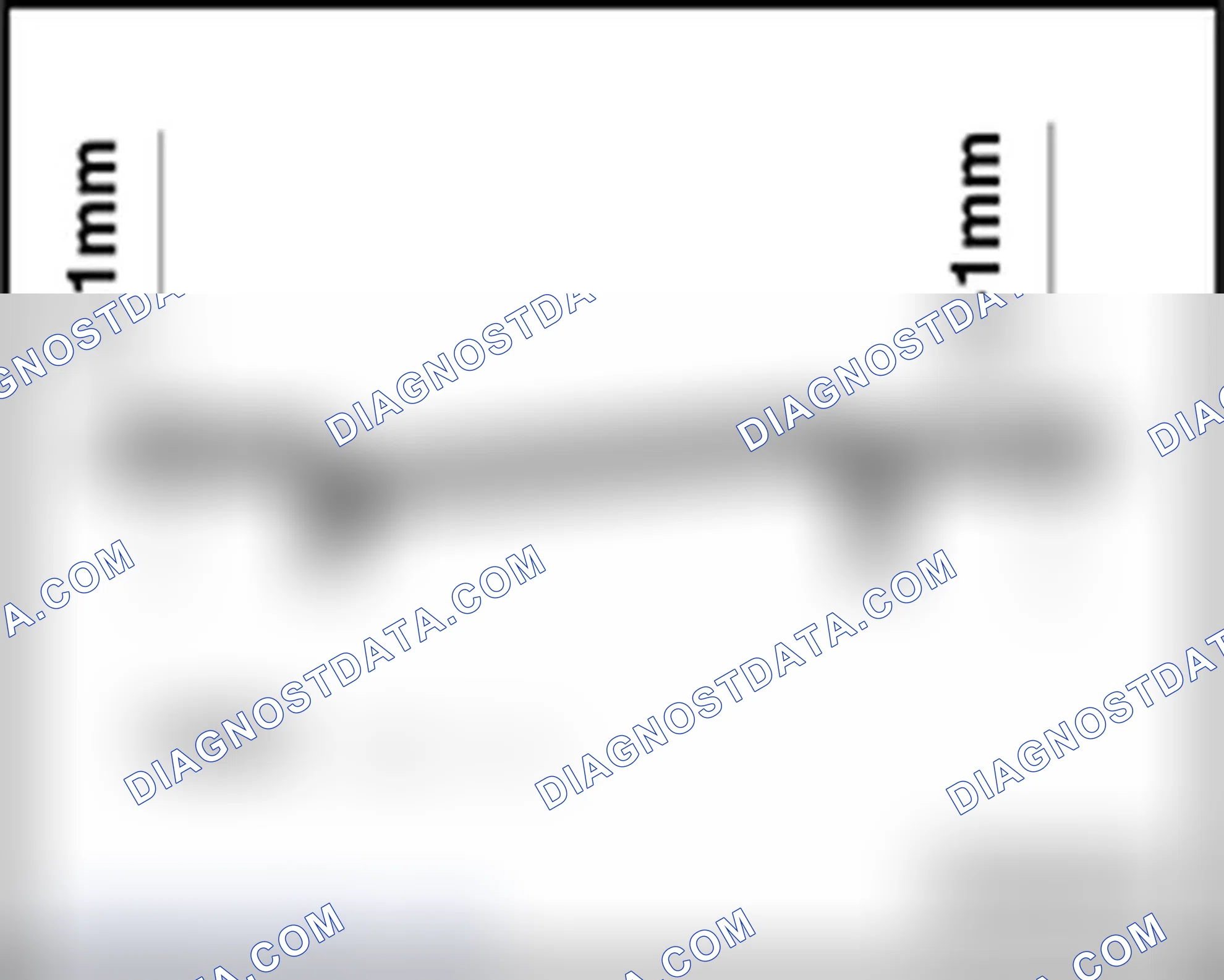 Scheme 136: Sunroof panel, adjusting