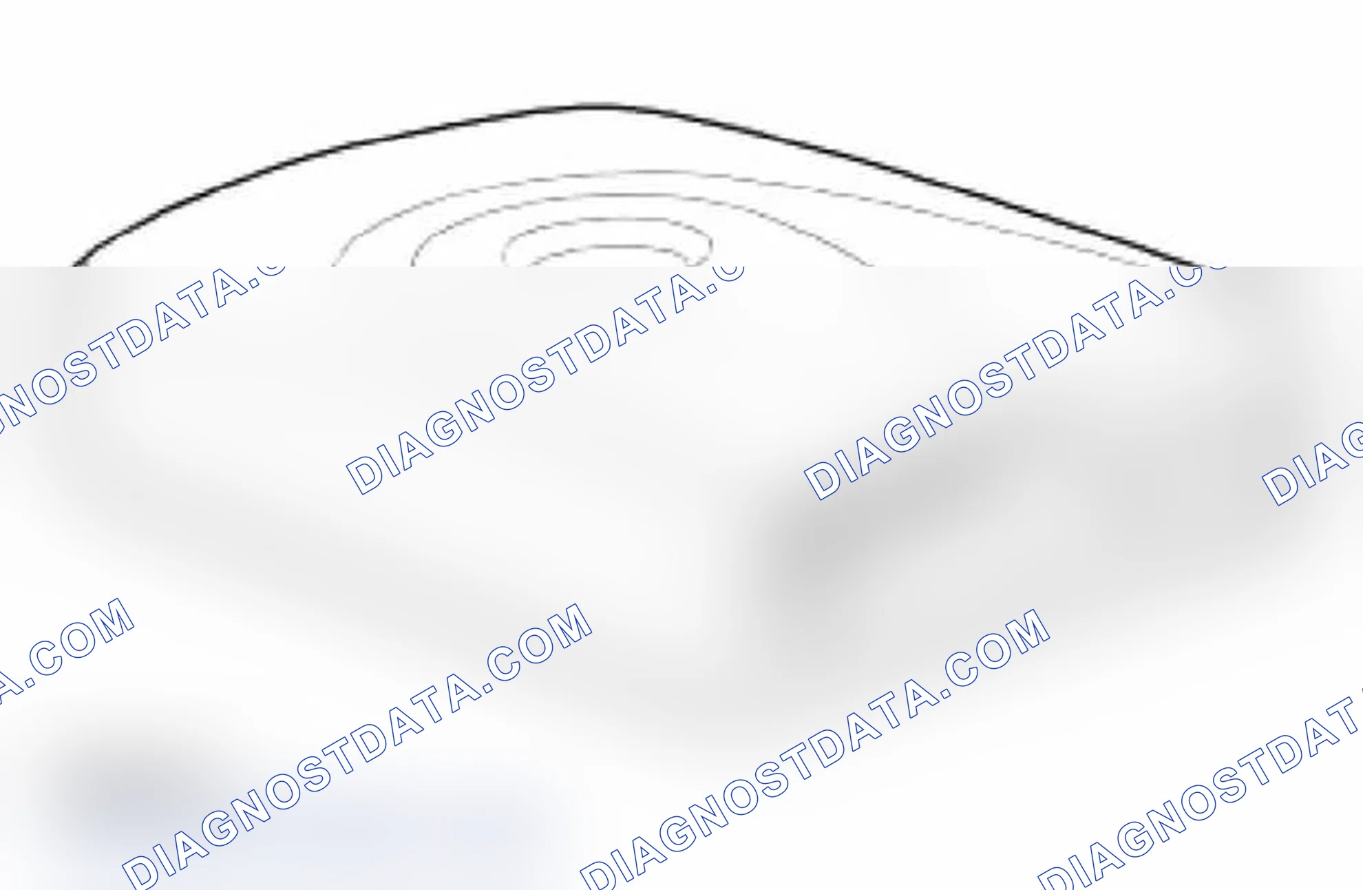 Scheme 17: Transceiver Module (TM)