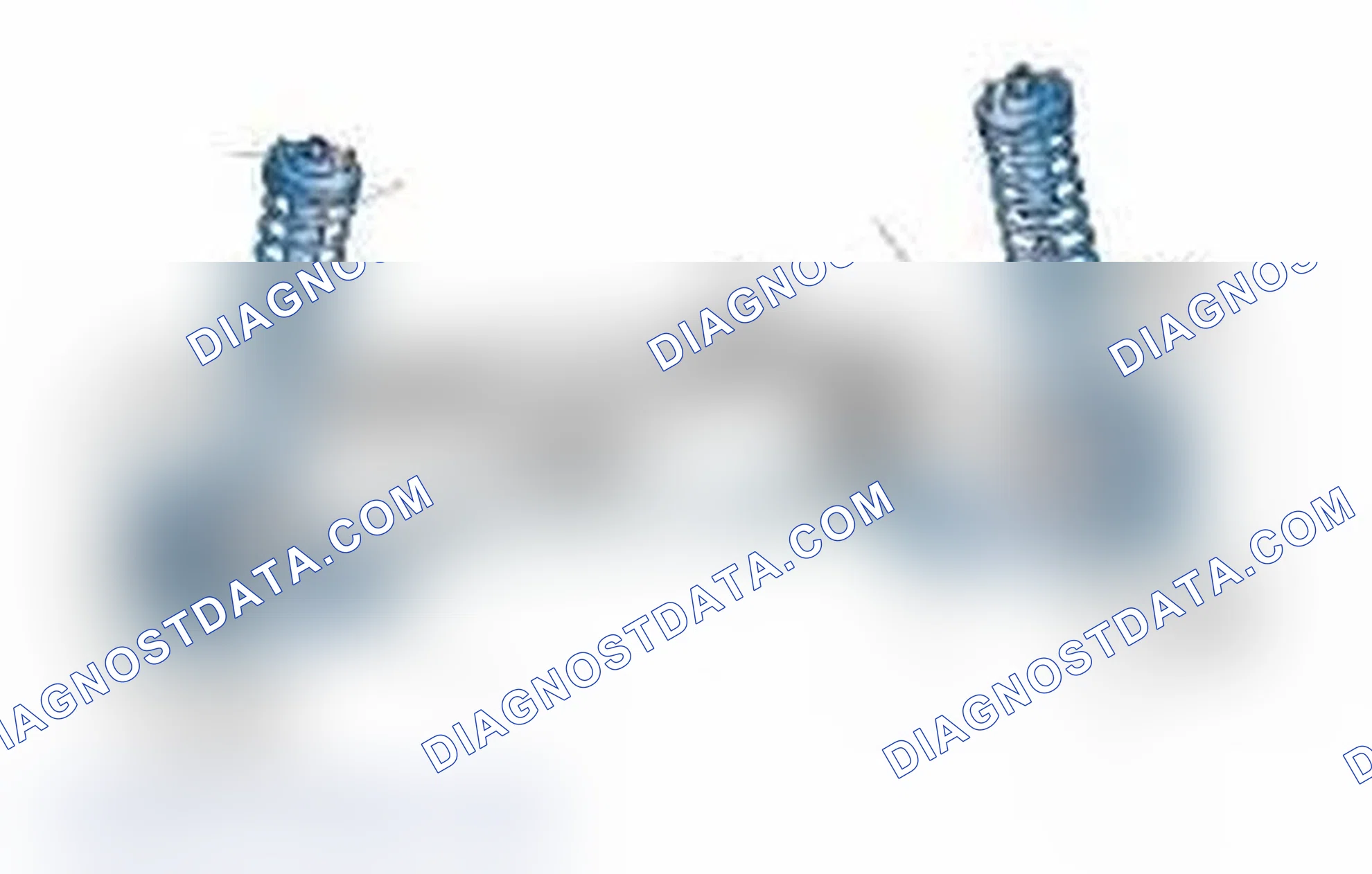 Scheme 25: Typical Front Suspension & Steering Components