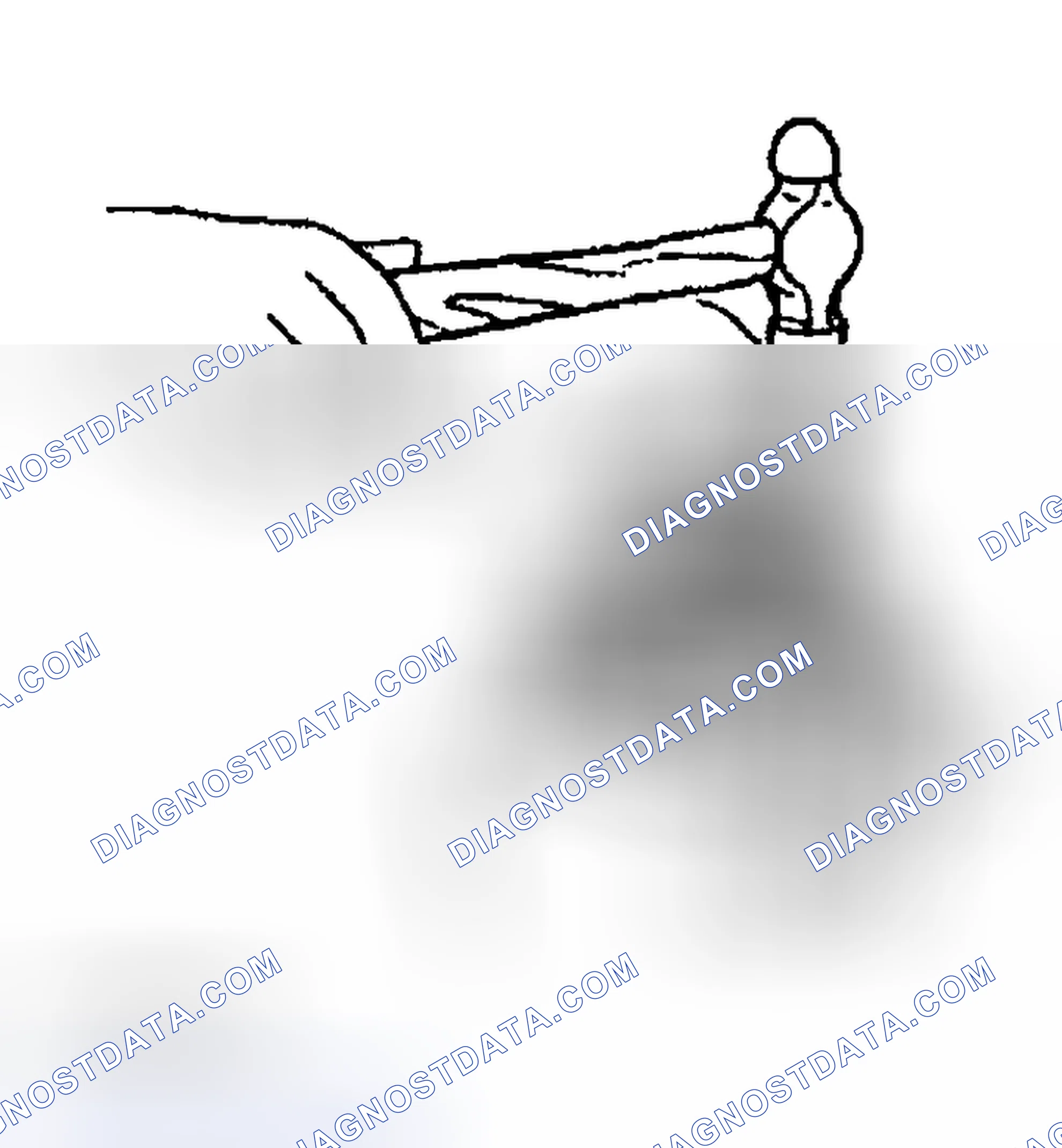 Scheme 22: Knock Pin (Standard) Disassembly Note