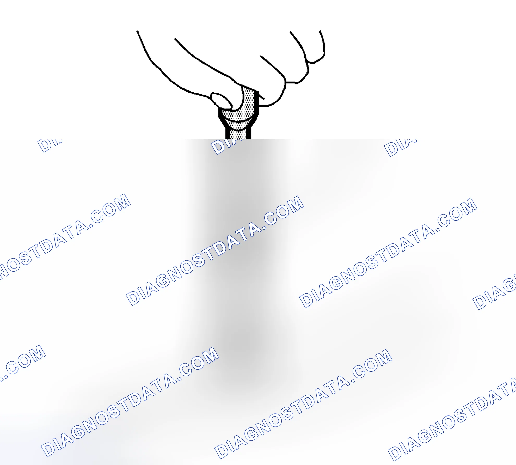 Scheme 14: Removal Procedure