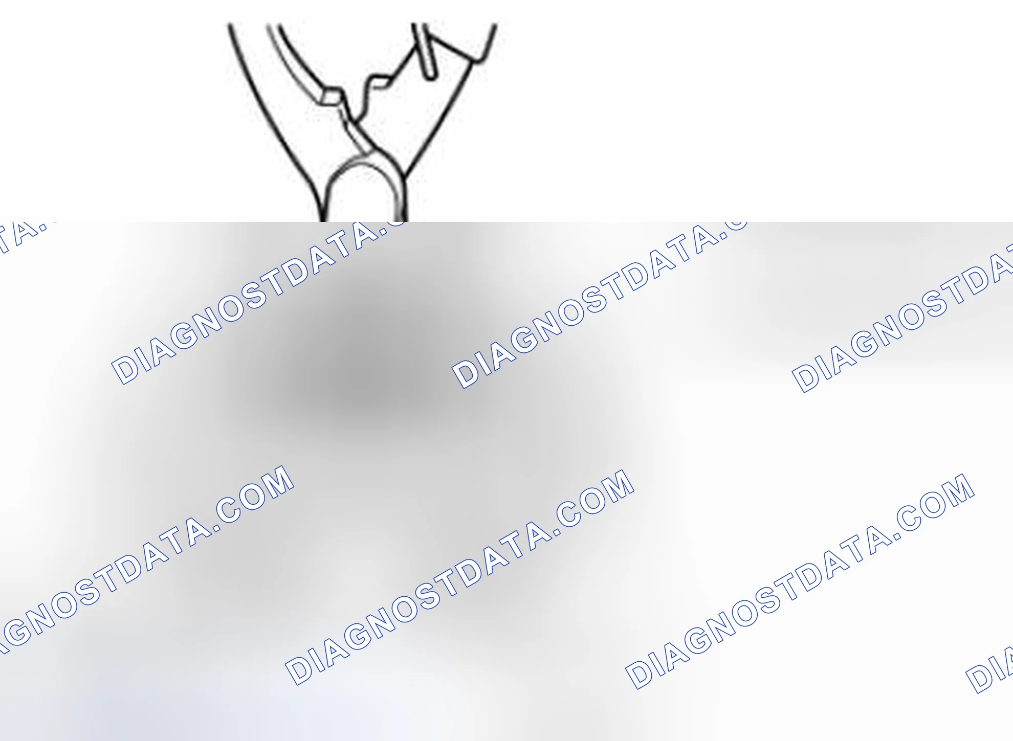 Scheme 106: Snap Ring Removal/Installation Note