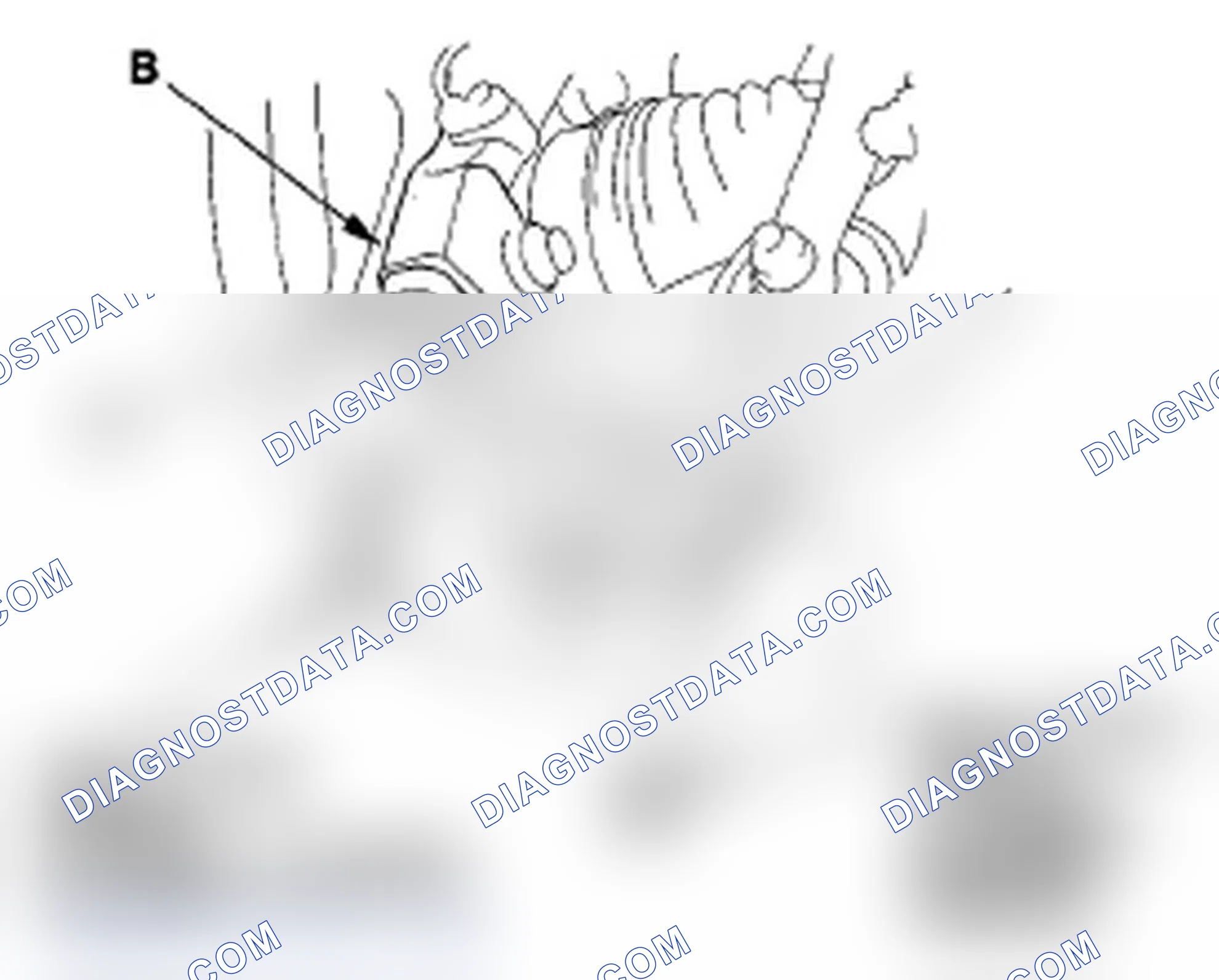 Scheme 18: Lower Arm Removal/Installation