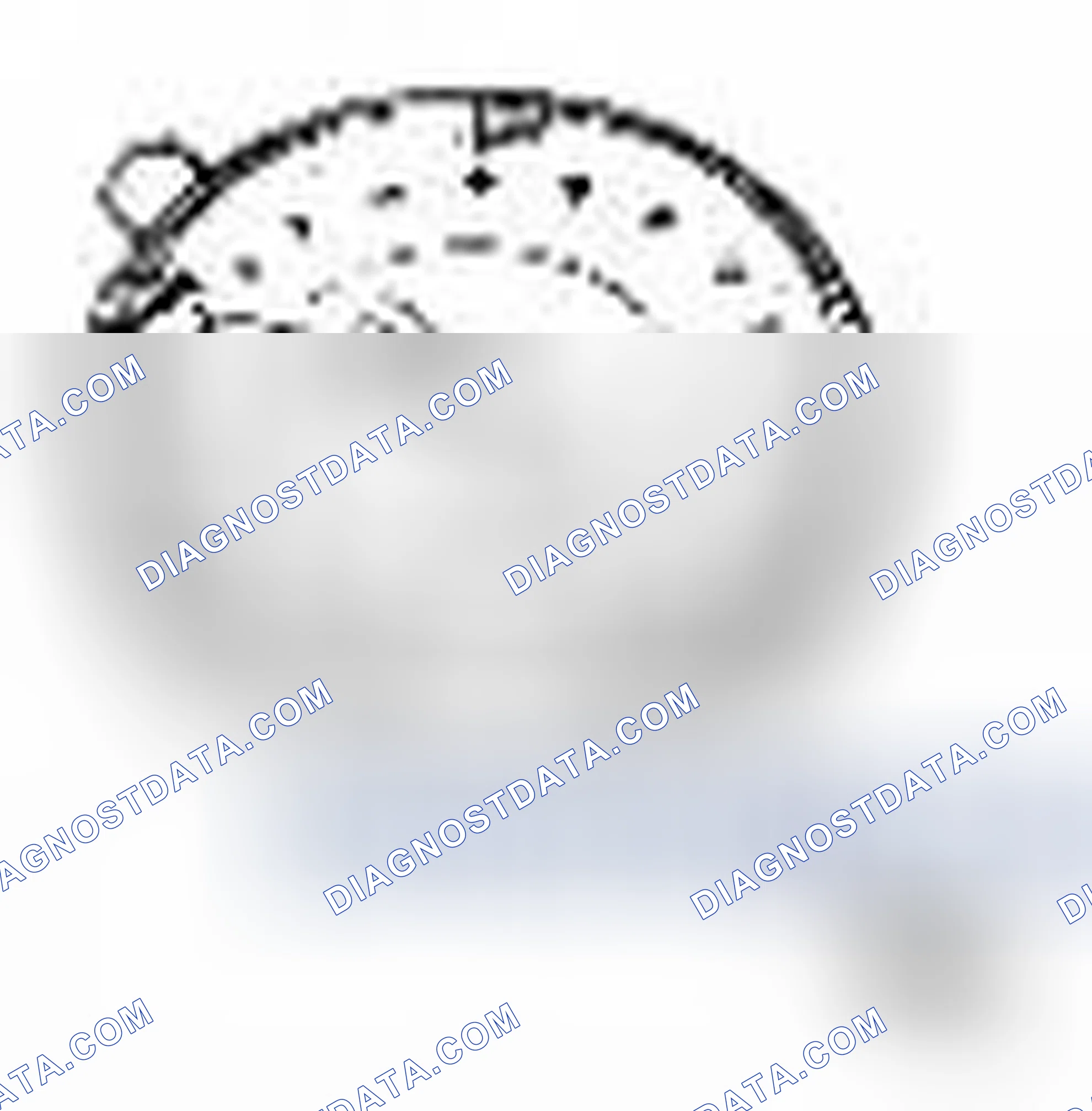 Scheme 73: Special Tool