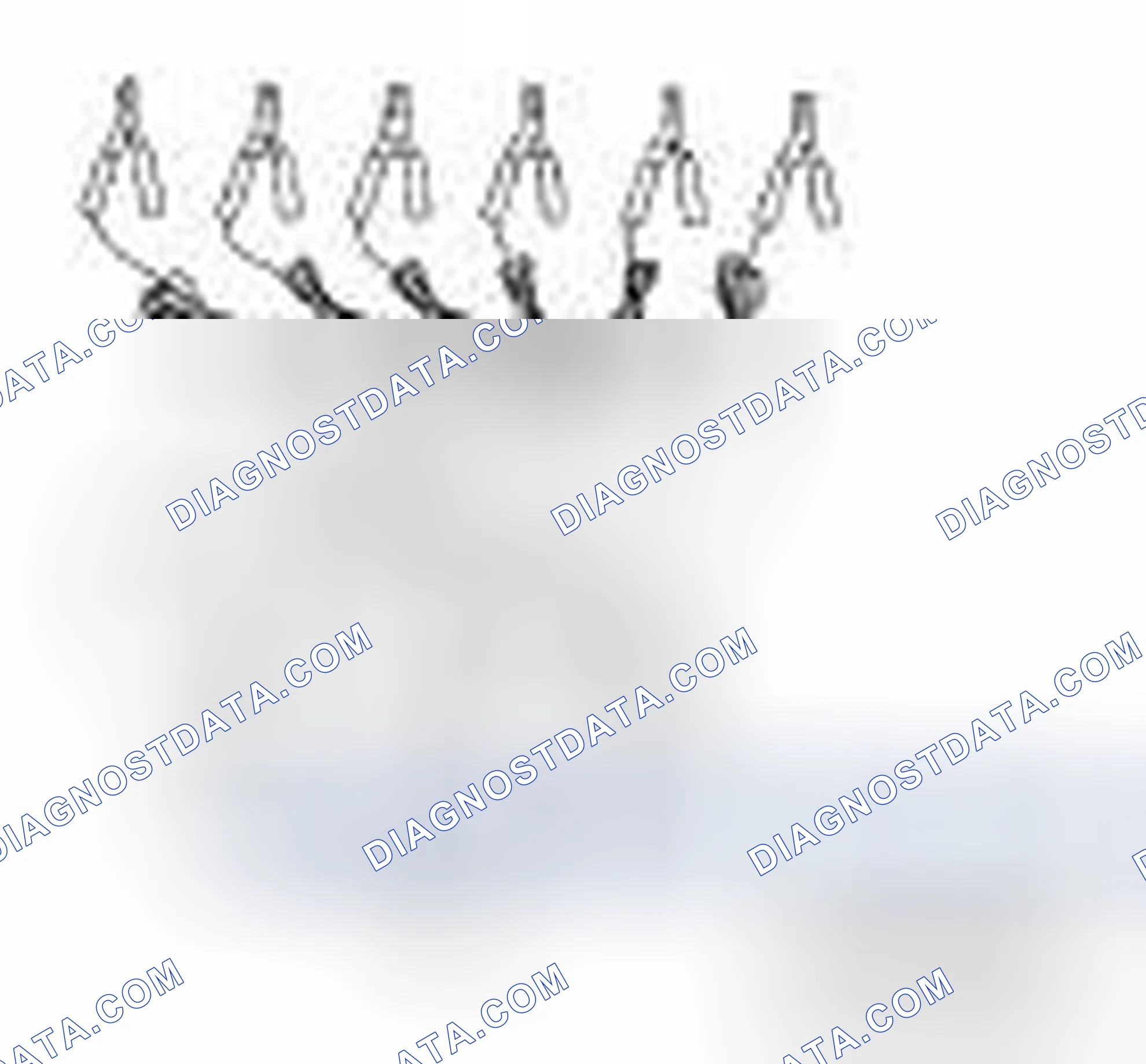 Scheme 9: Special Service Tools