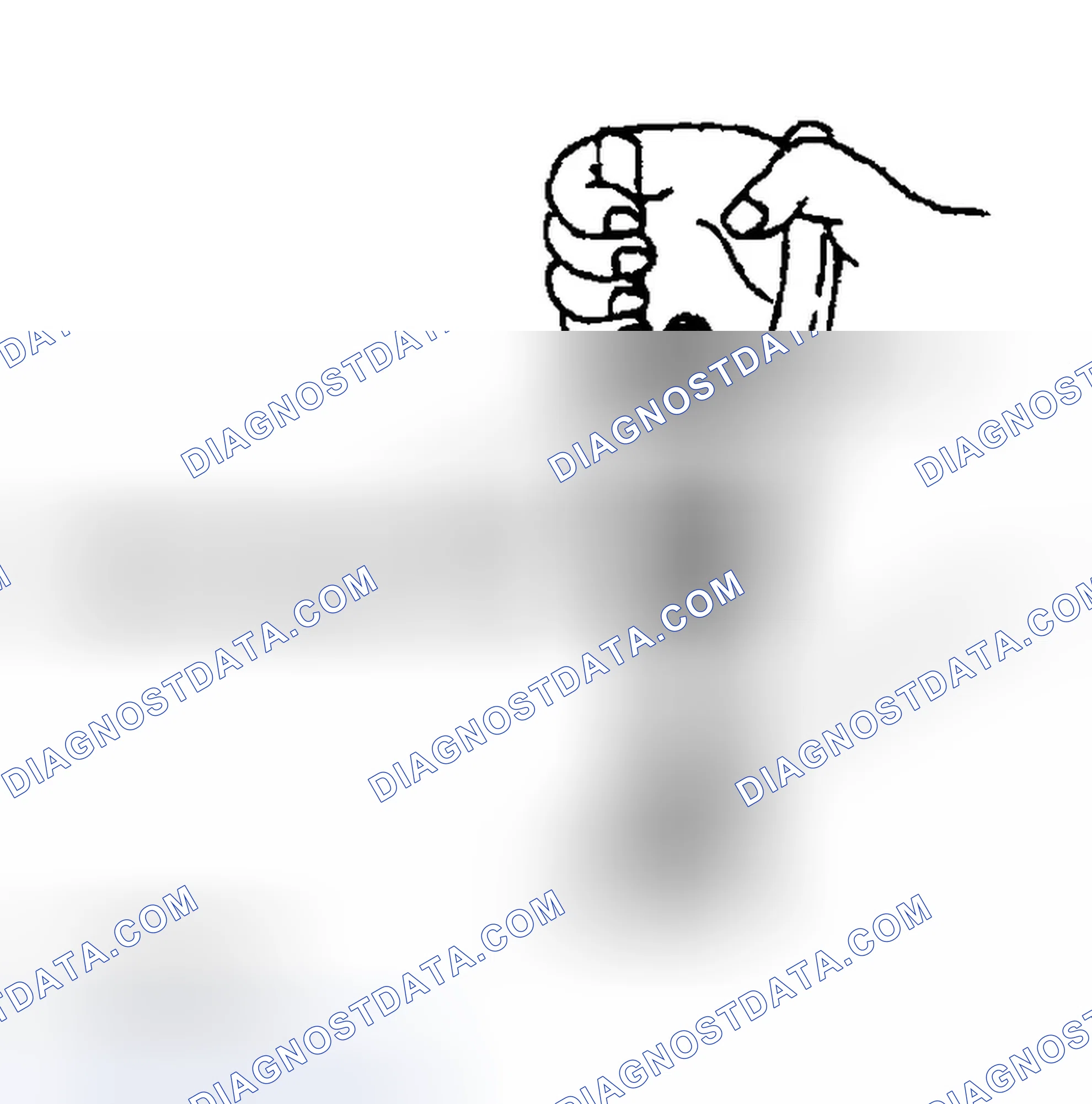 Scheme 21: Mounting Nut Removal Note