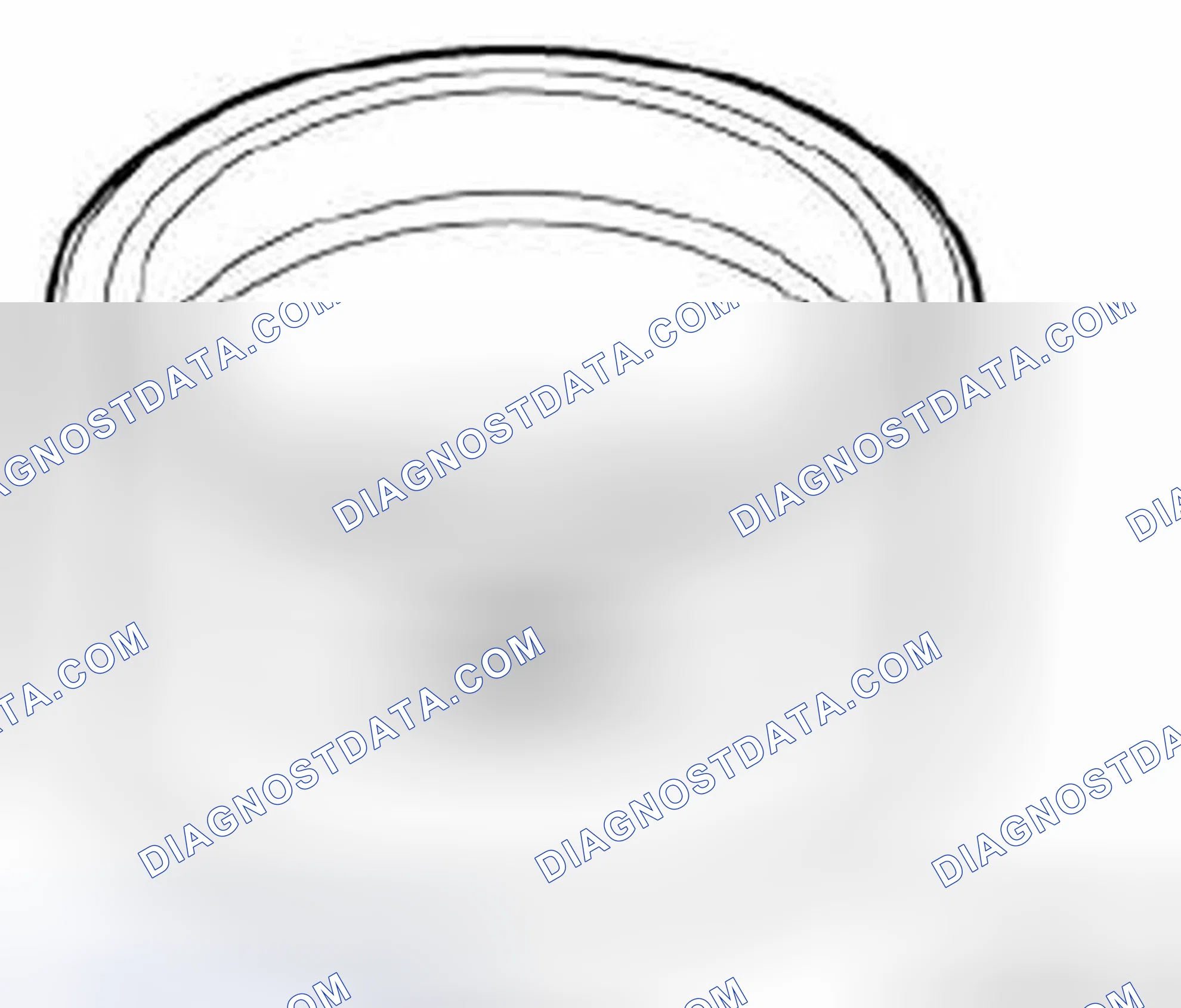 Scheme 69: 11 6 260 Mounting Sleeves With Case