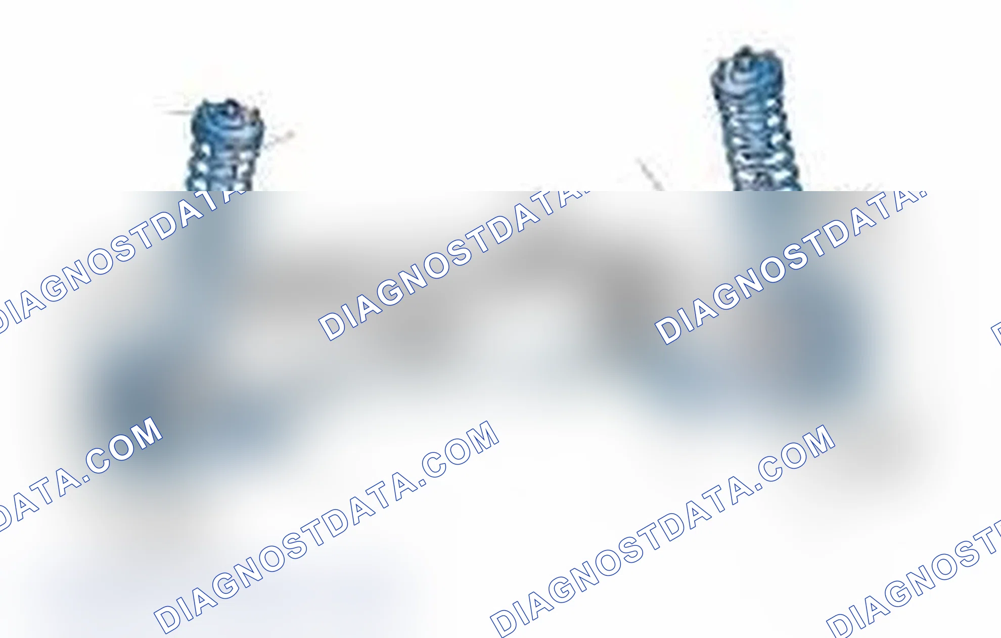 Scheme 25: Typical Front Suspension & Steering Components