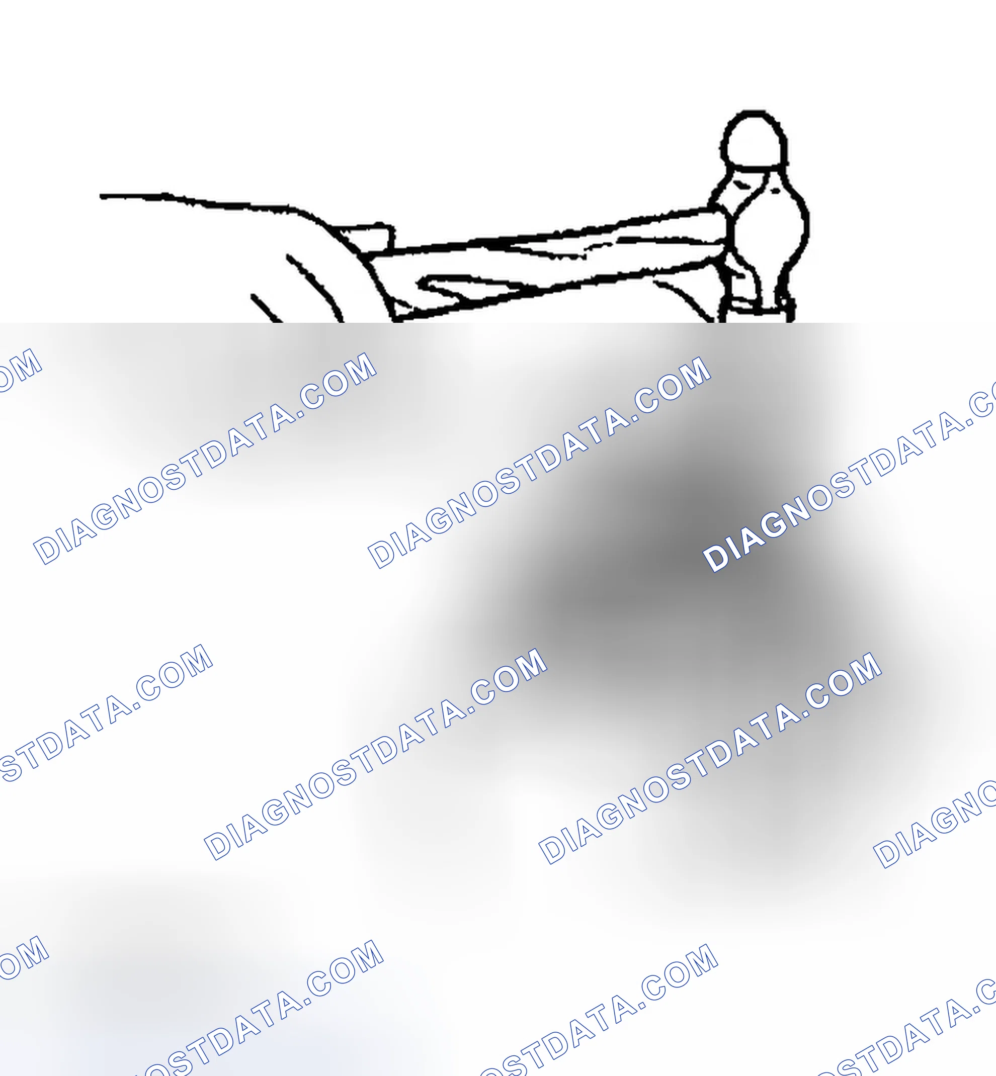 Scheme 22: Knock Pin (Standard) Disassembly Note