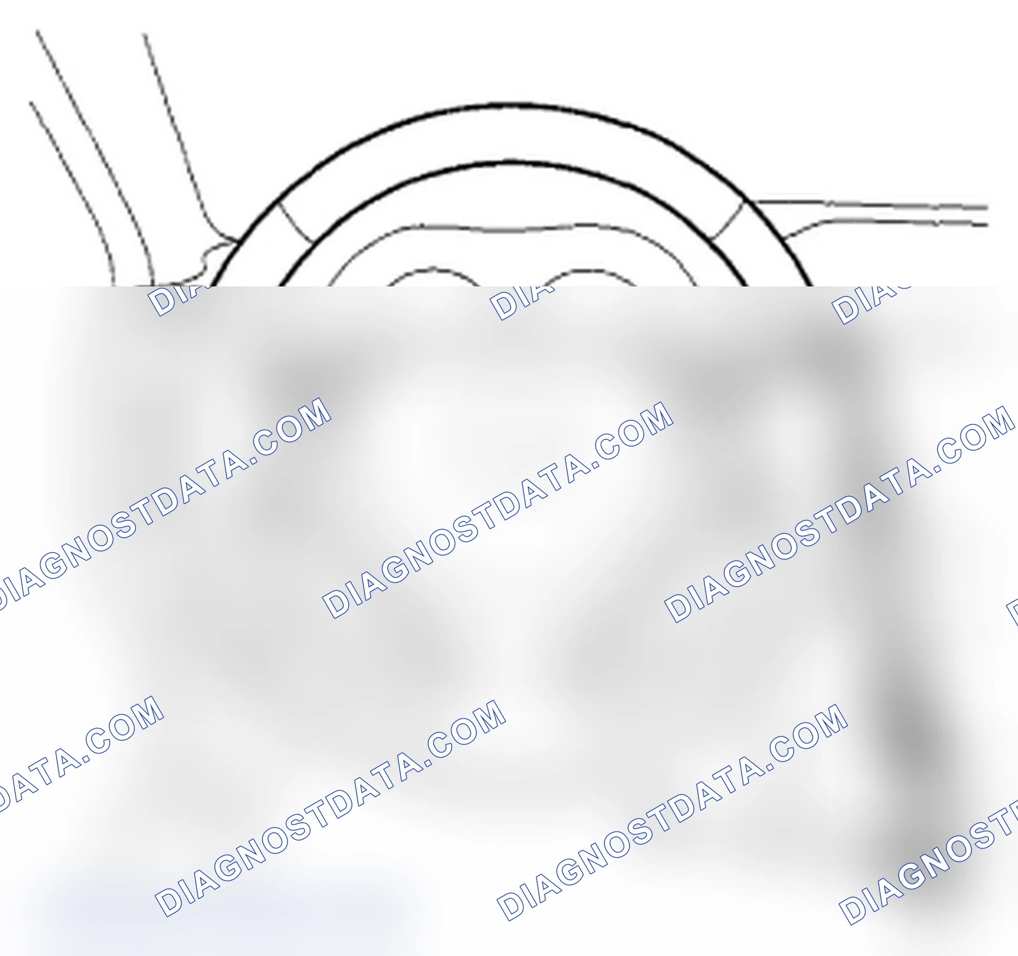 Scheme 4: Power Assist Check
