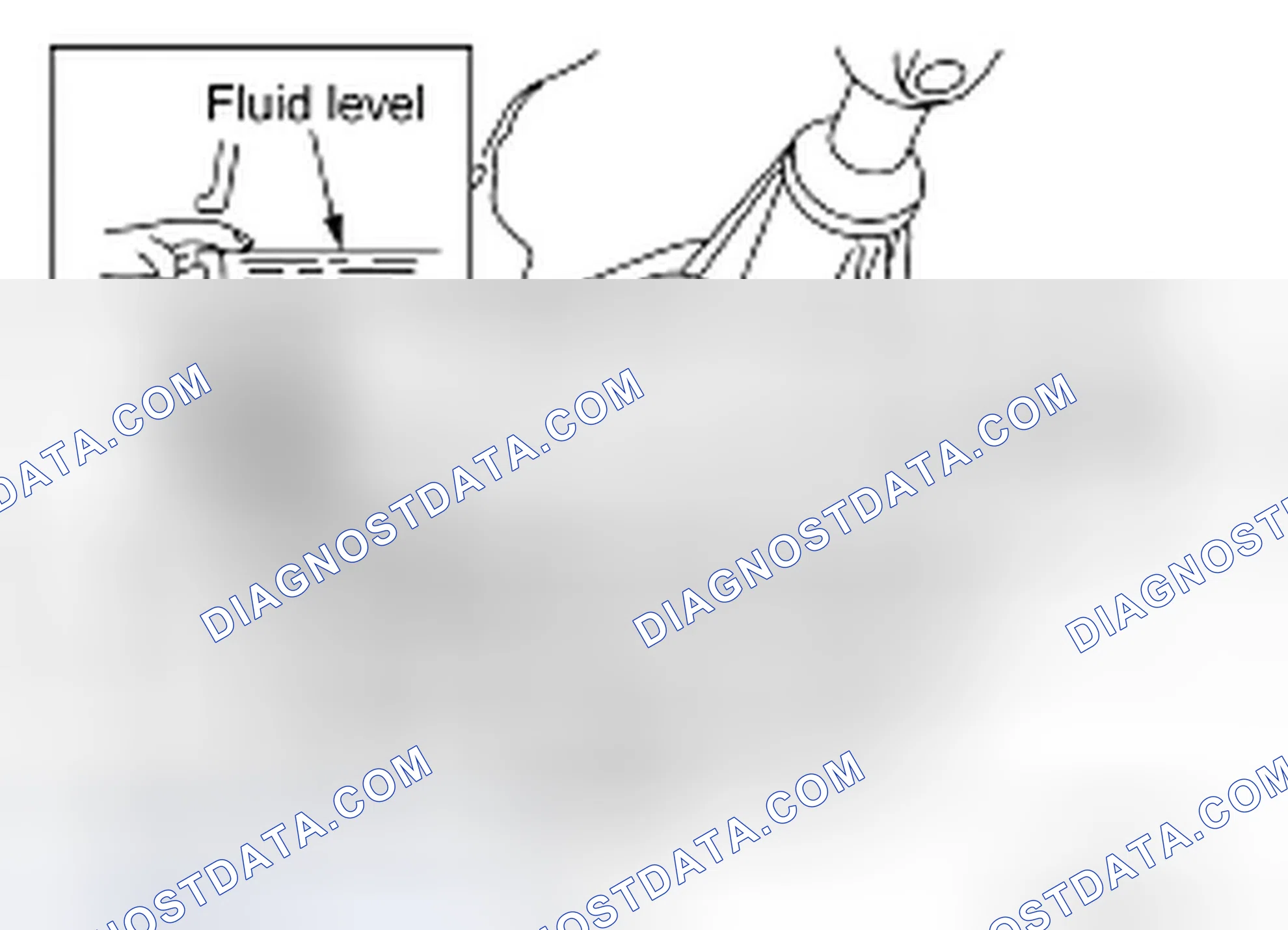 Scheme 40: FLUID LEAKAGE AND FLUID LEVEL