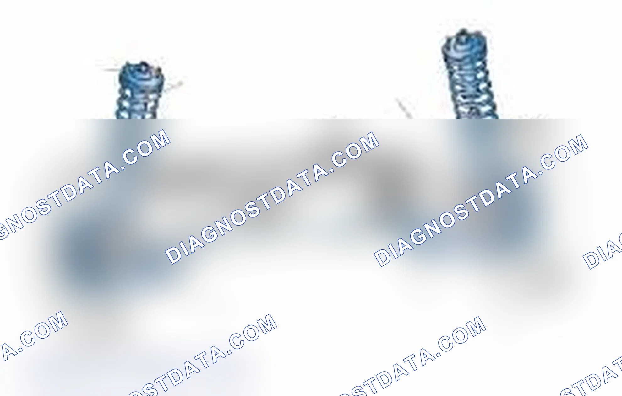Scheme 25: Typical Front Suspension & Steering Components