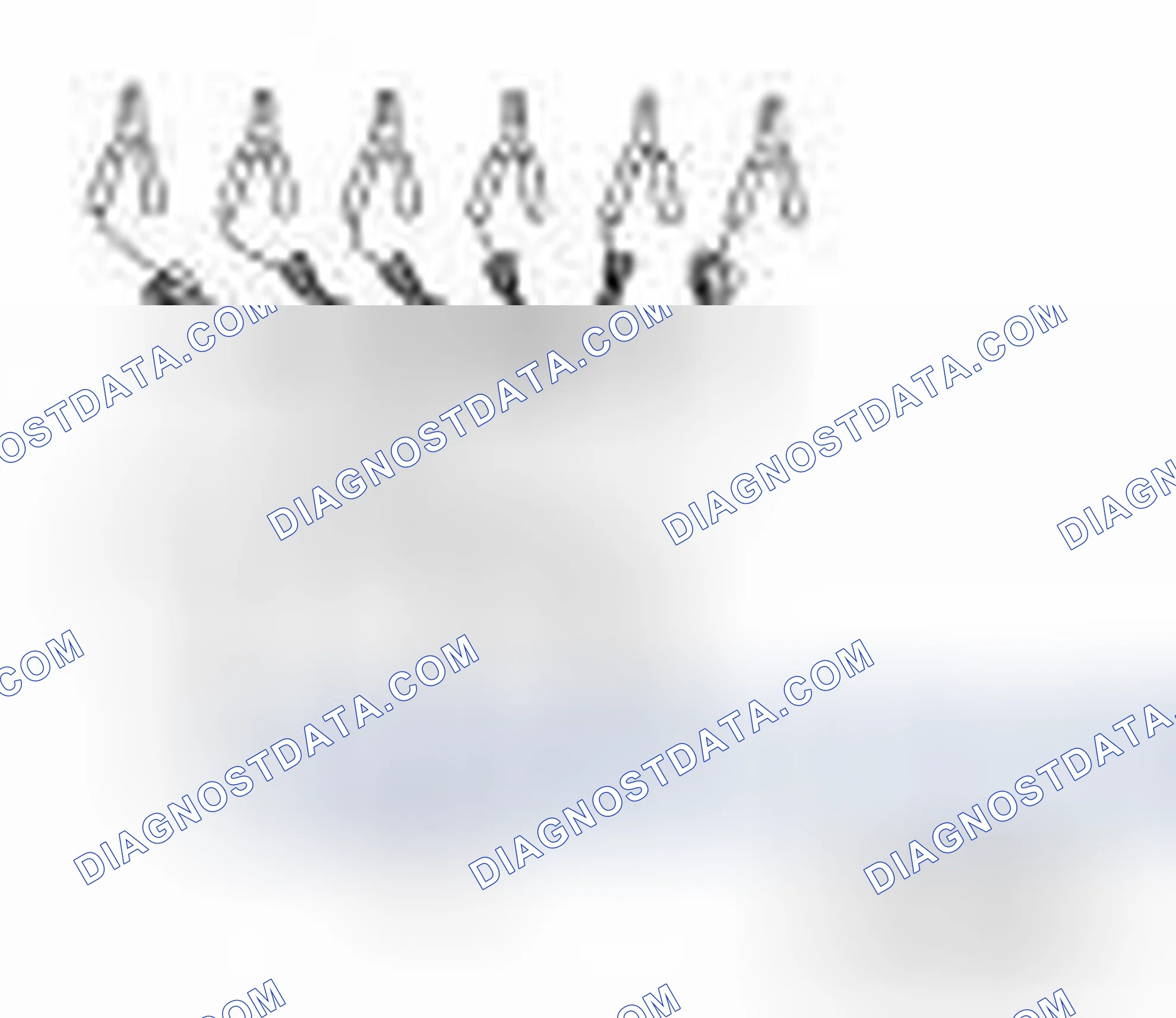 Scheme 35: Special Service Tools