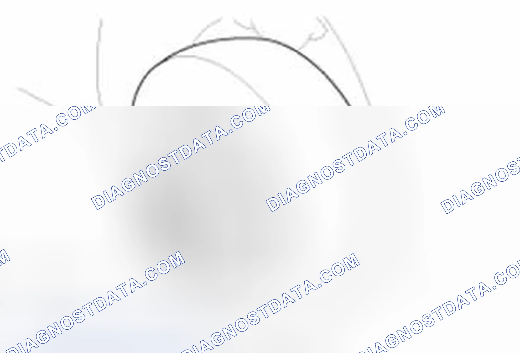 Scheme 29: Disassembly