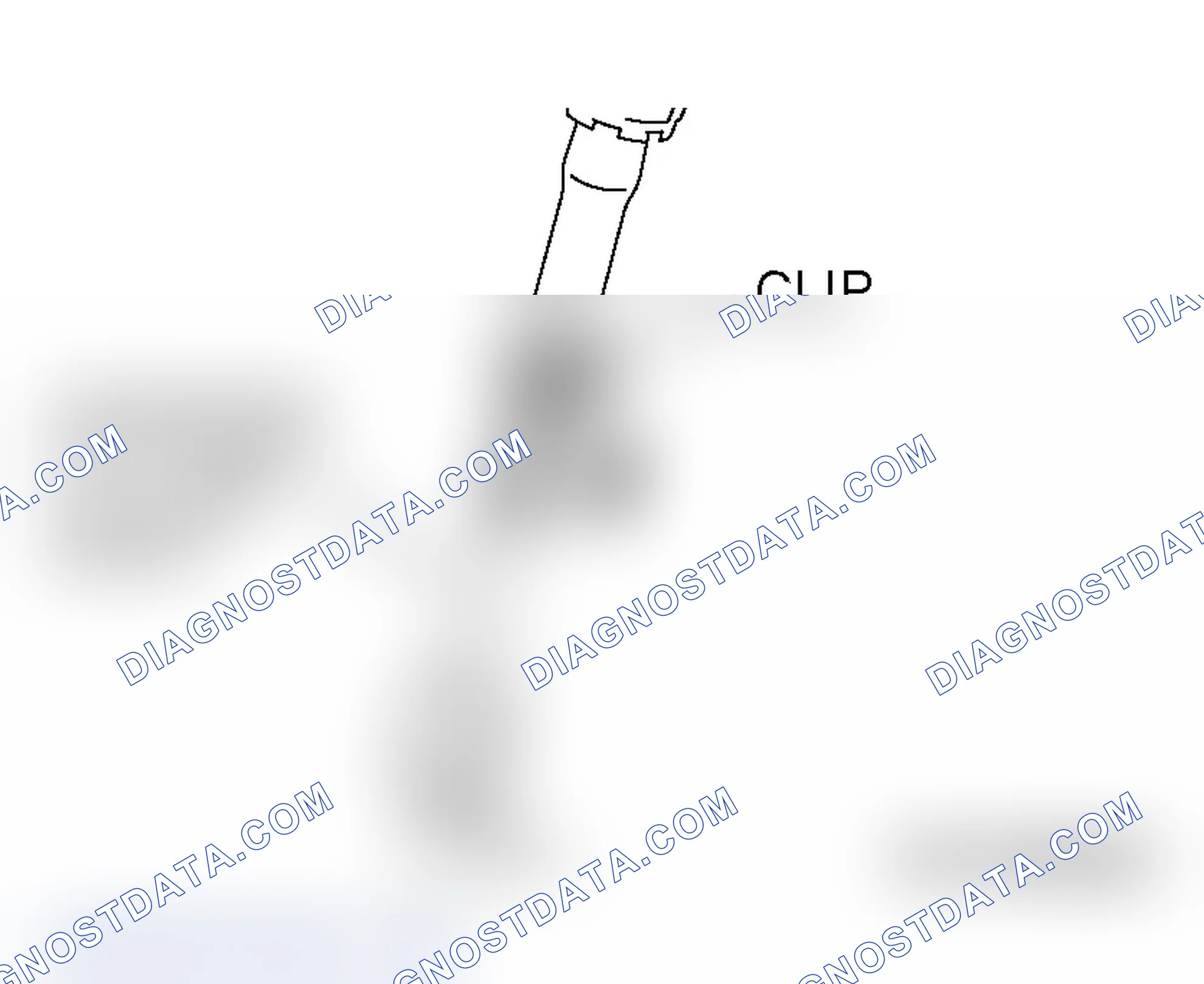 Scheme 147: << A >> STEERING COLUMN SHAFT ASSEMBLY REMOVAL