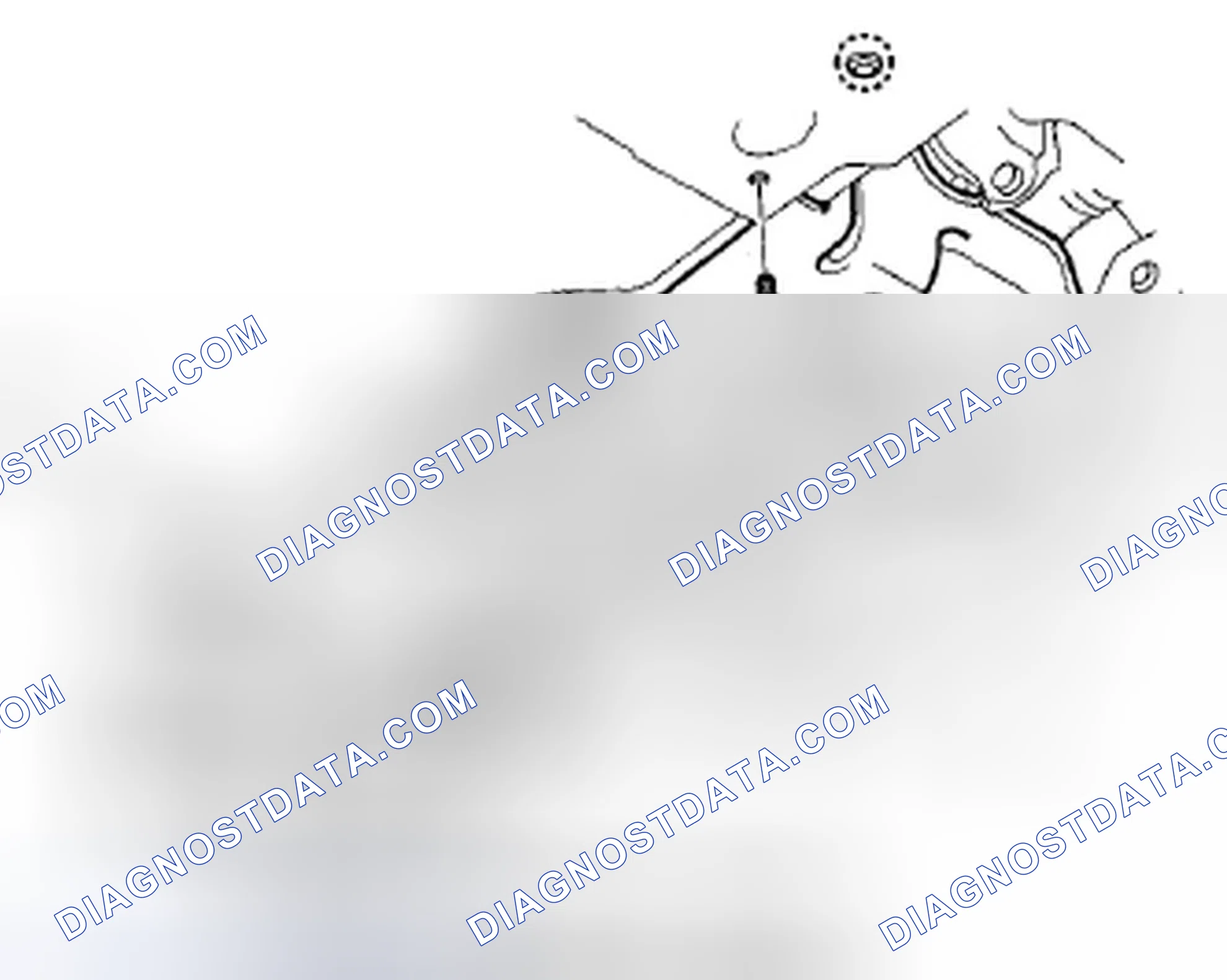 Scheme 38: Stabilizer Bar Replacement