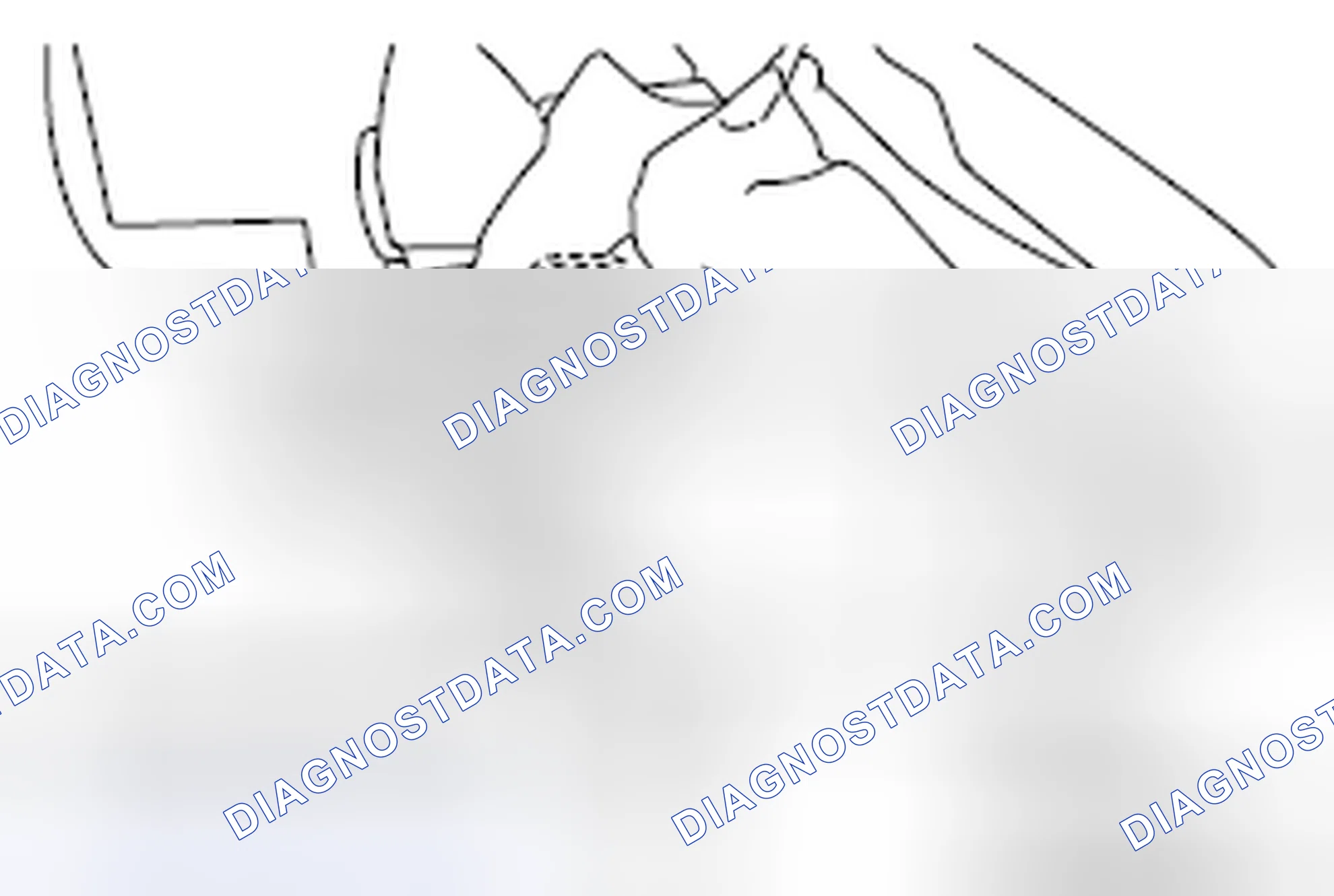 Scheme 5: REPAIR PROCEDURE OF BRACKET B