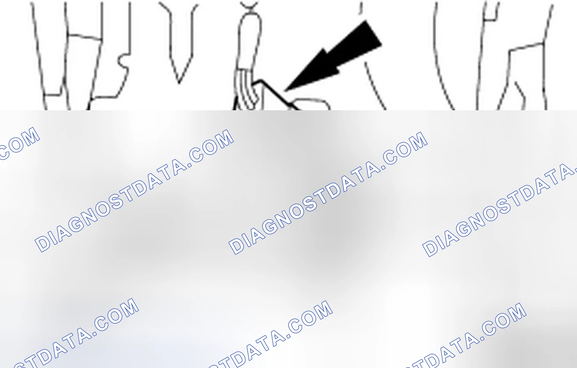 Scheme 5: REMOVAL AND INSTALLATION
