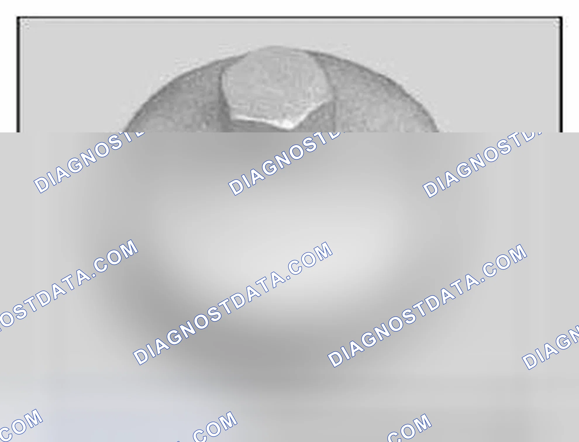 Scheme 831: 11 9 240 Oil filter wrench