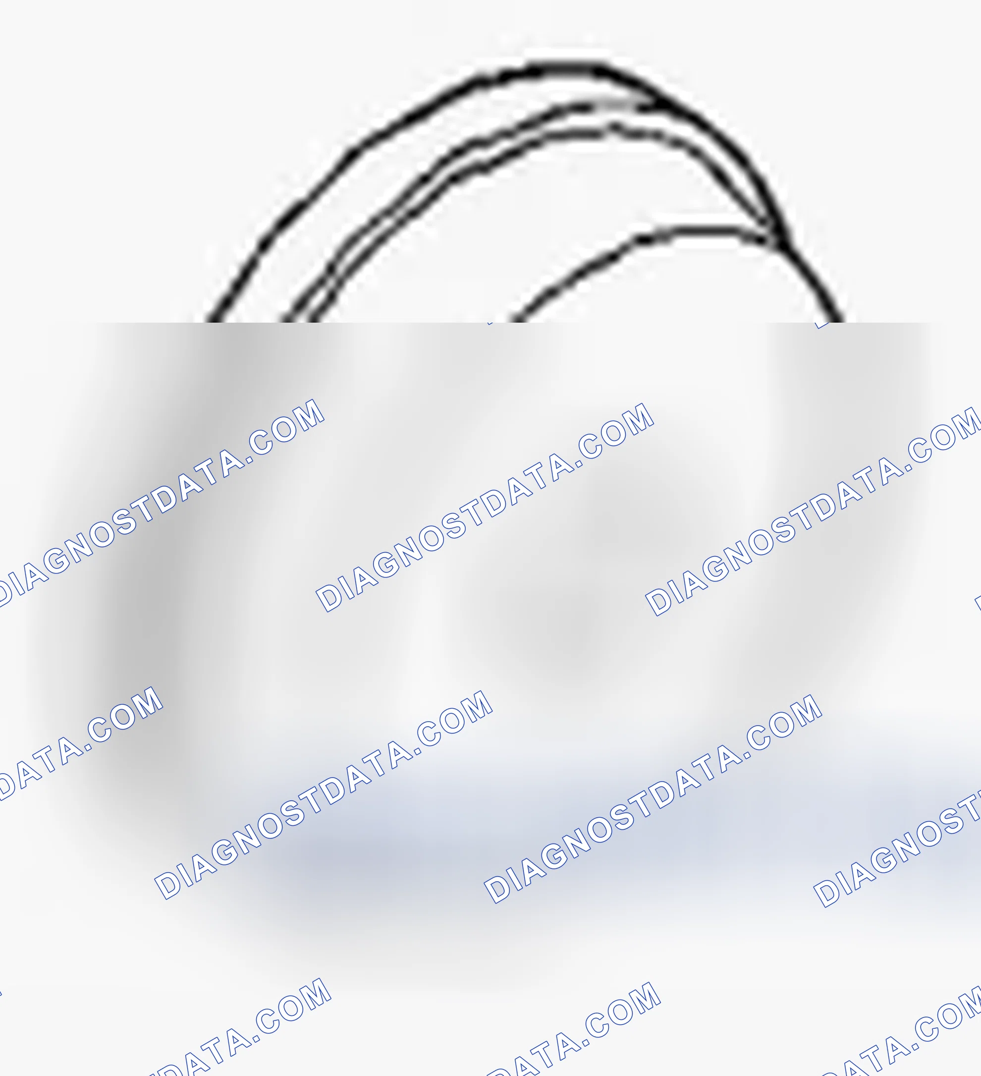 Scheme 61: SPECIAL TOOLS