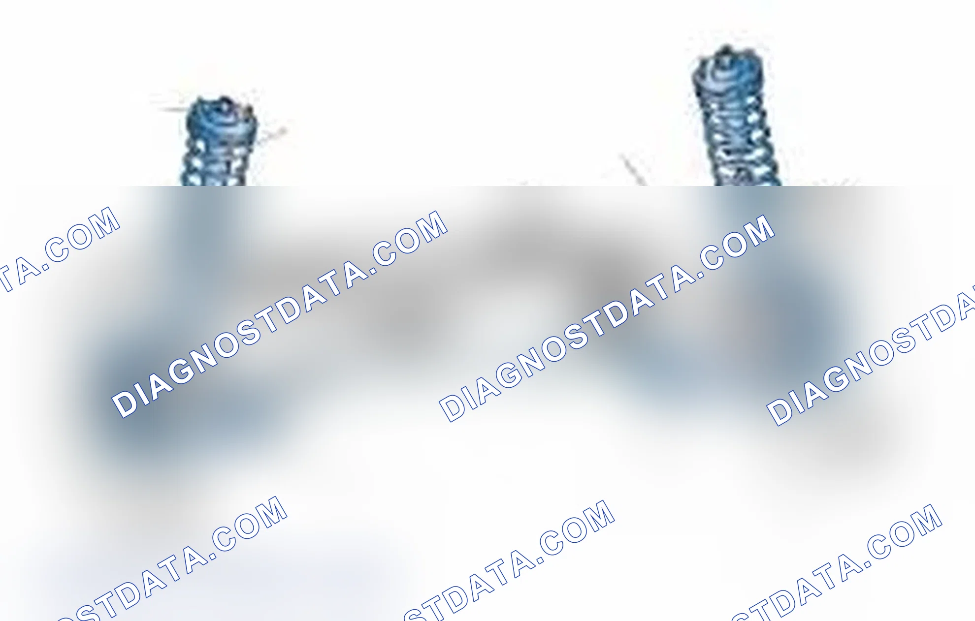 Scheme 25: Typical Front Suspension & Steering Components
