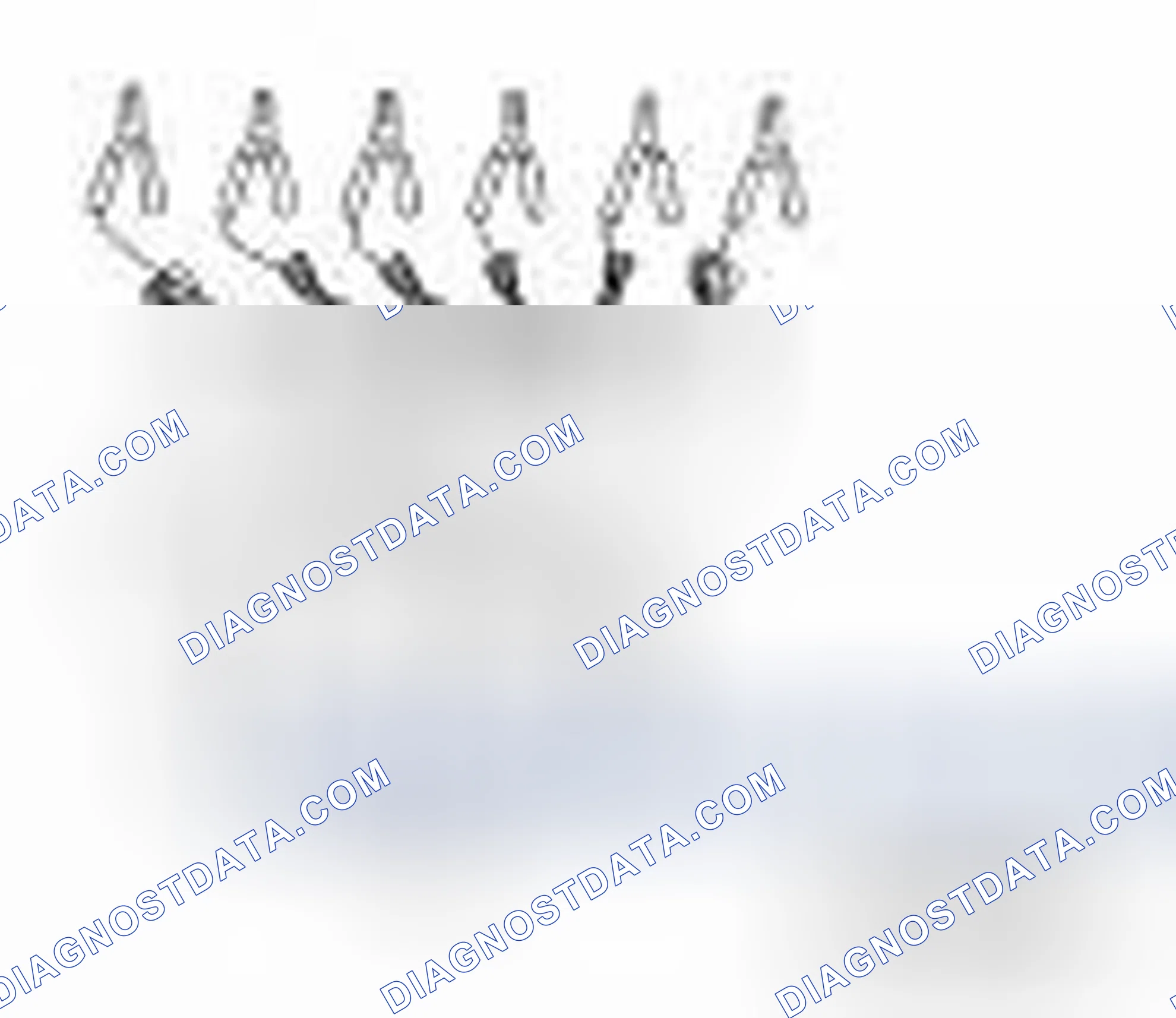 Scheme 134: Special Service Tool