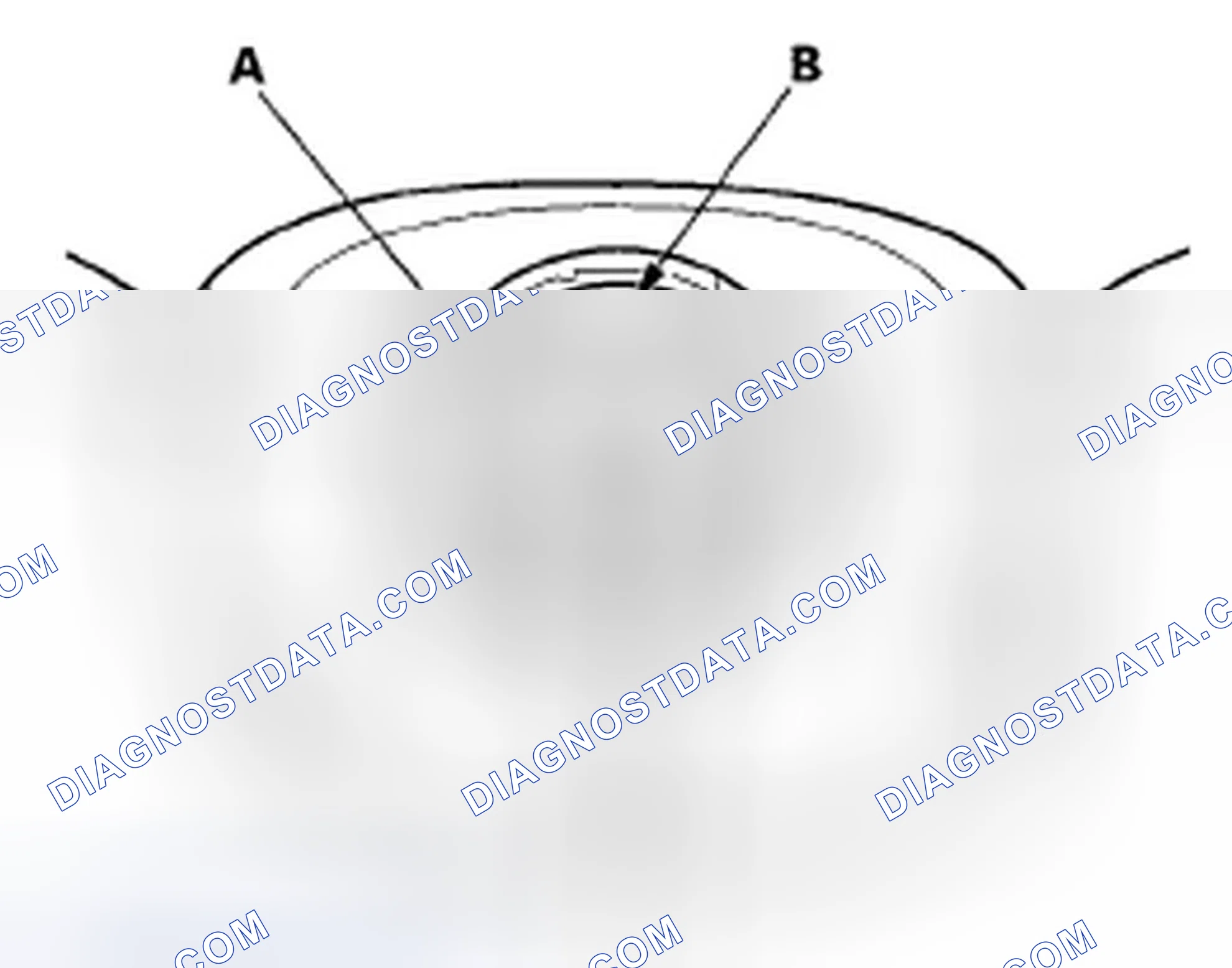 Scheme 142: Steering Wheel Installation