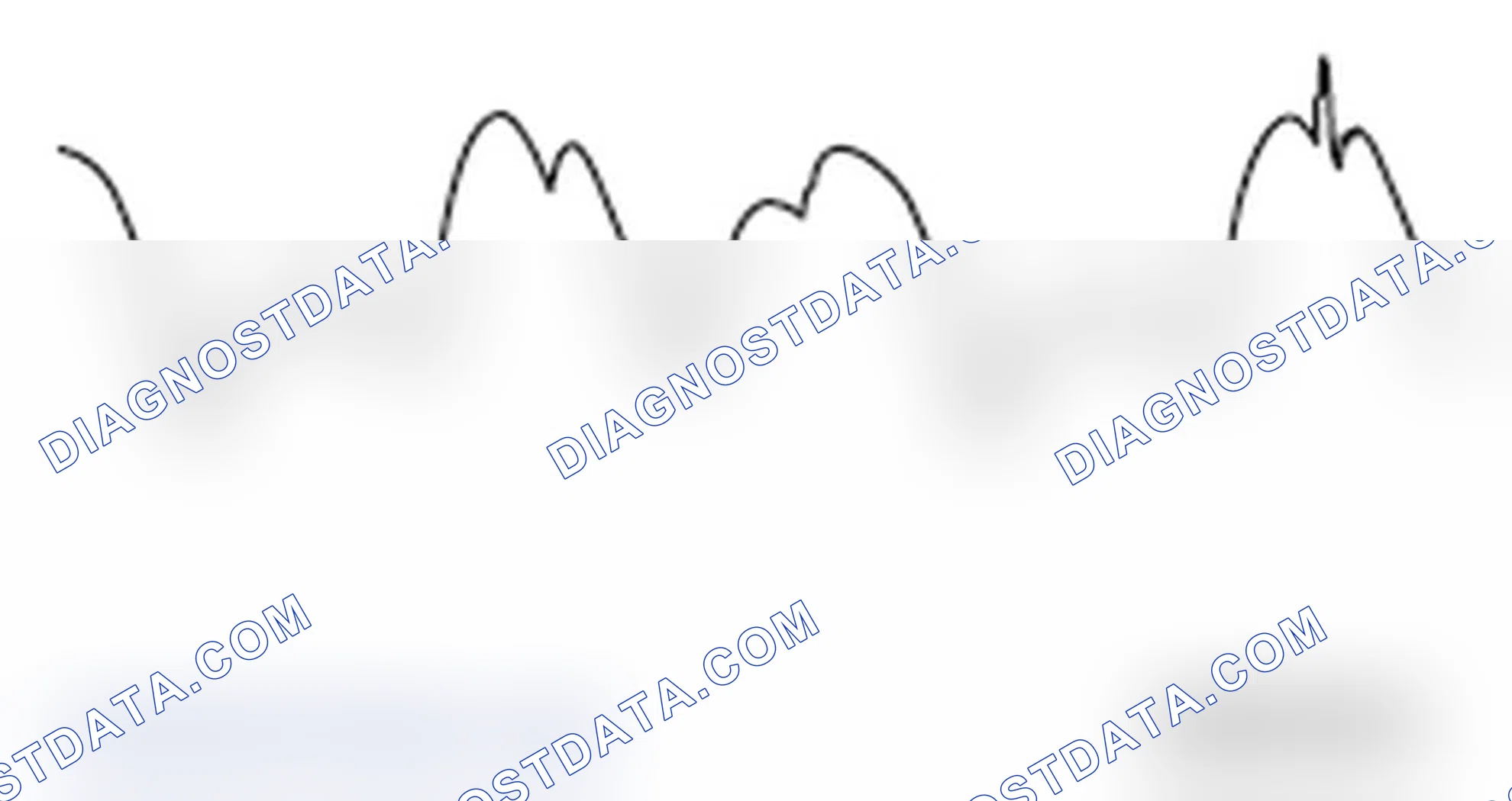 Scheme 11: ABNORMAL WAVEFORMS