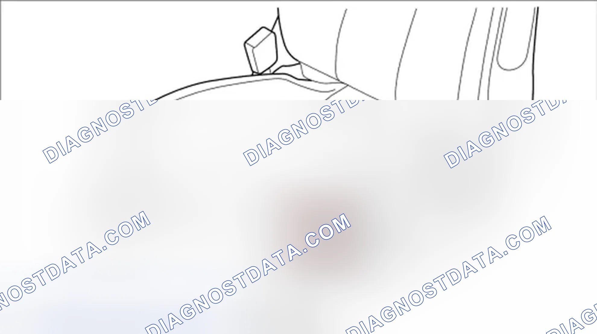 Scheme 22: Removing motor for front vertical adjustment