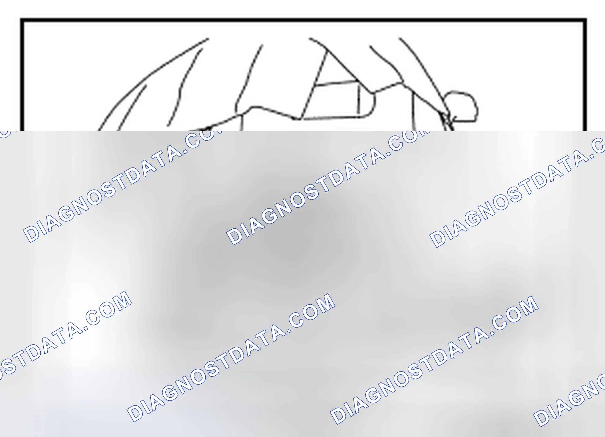 Scheme 230: Removal