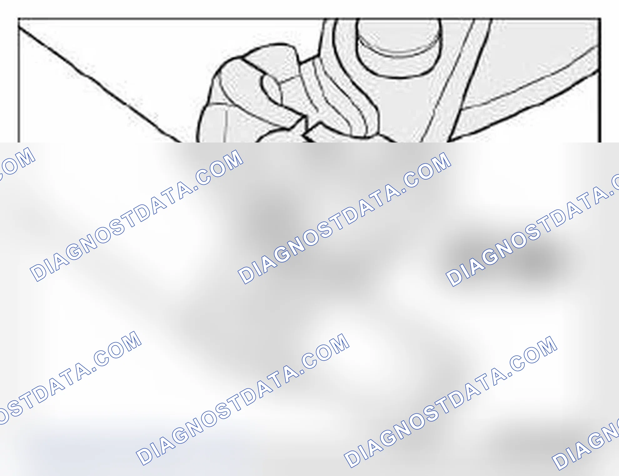 Scheme 38: 32 41... Instructions for removing and installing ear clips