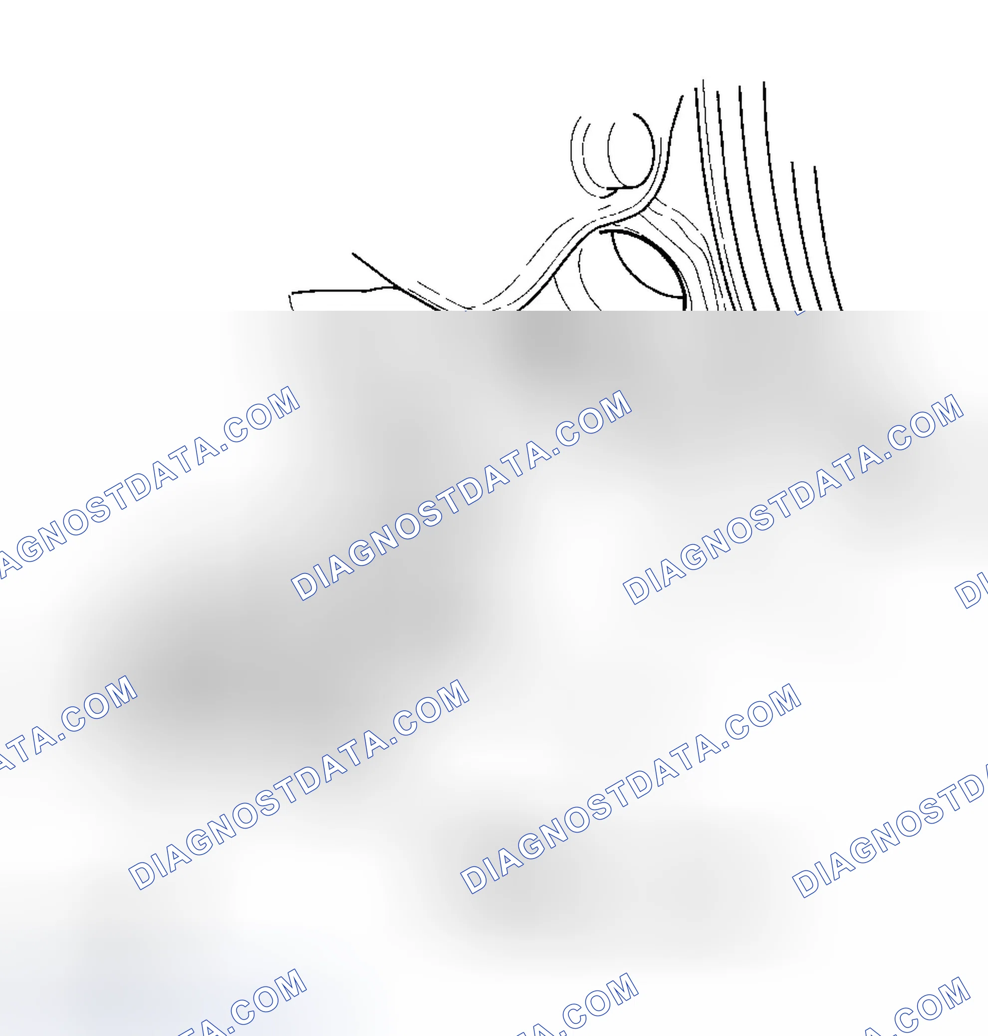 Scheme 171: CKP Sensor Replacement