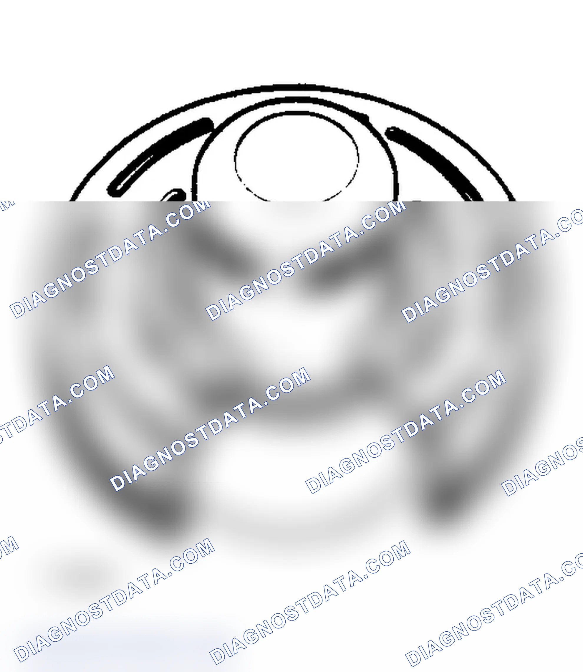 Scheme 29: Remove Bearing
