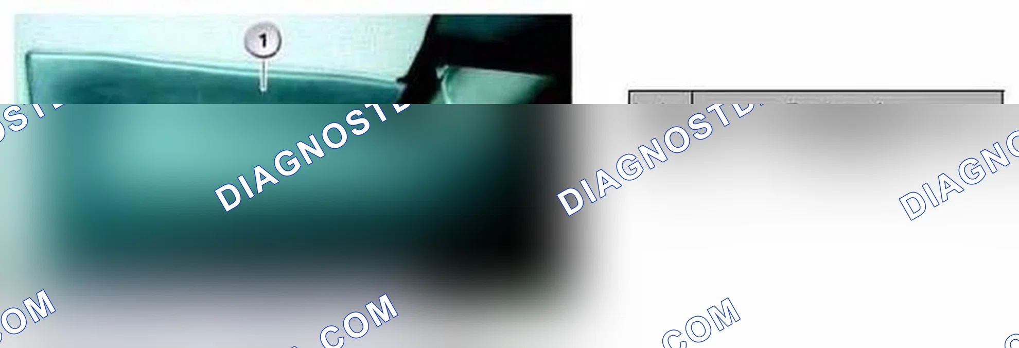 Scheme 69: Knee Airbag