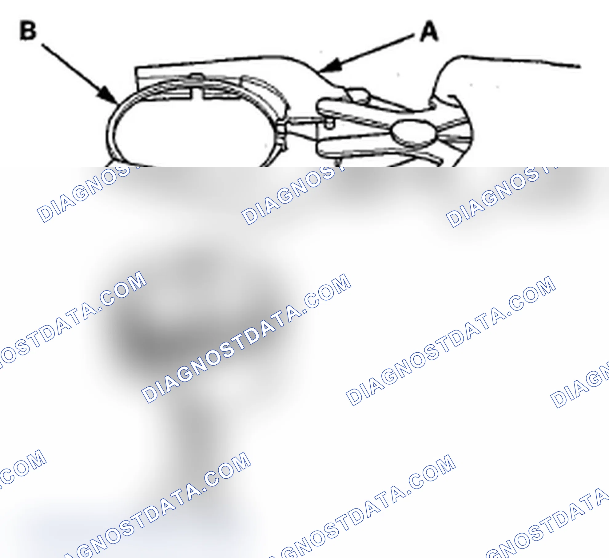 Scheme 325: Piston Ring Replacement