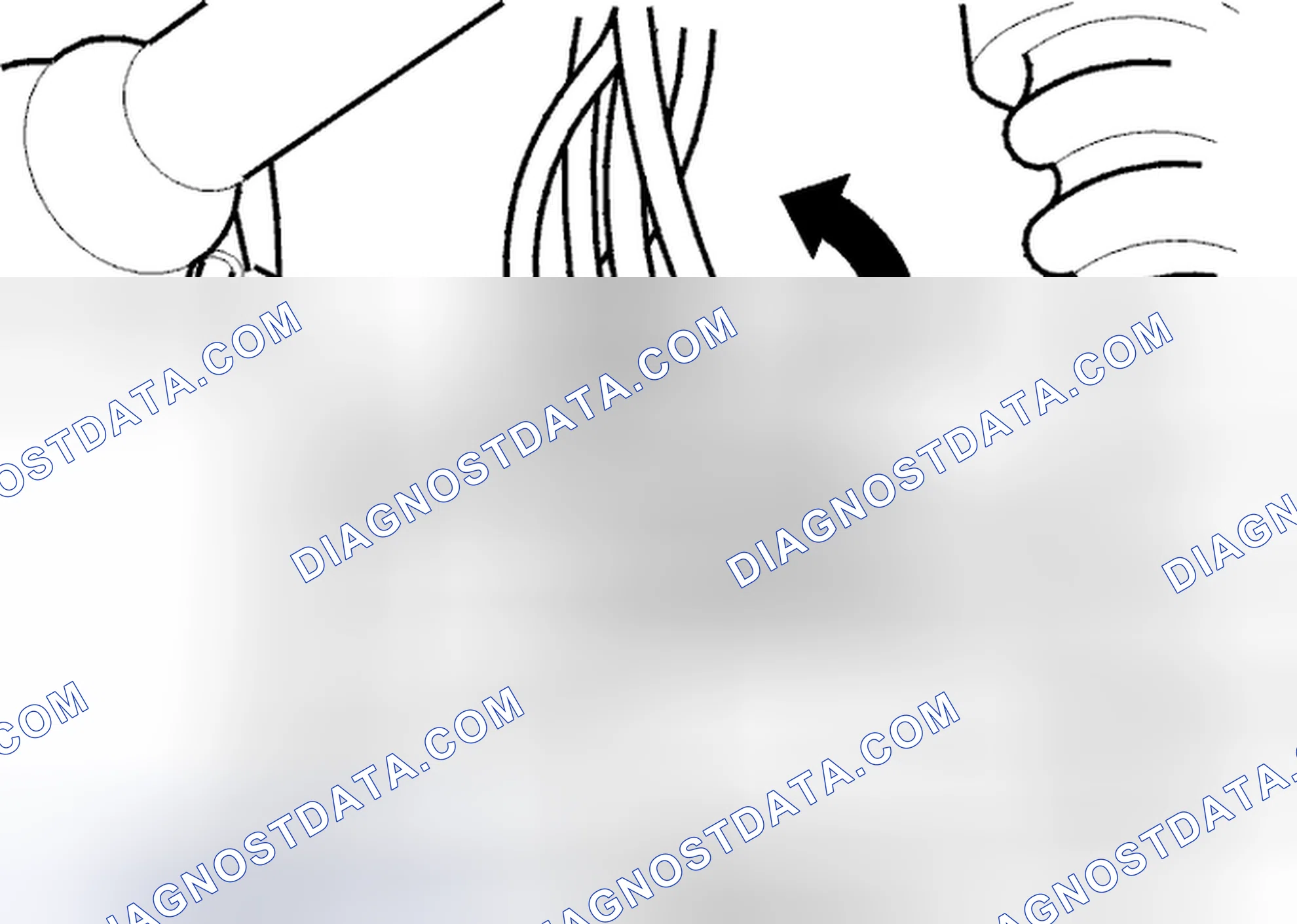 Scheme 333: Removing front bracket