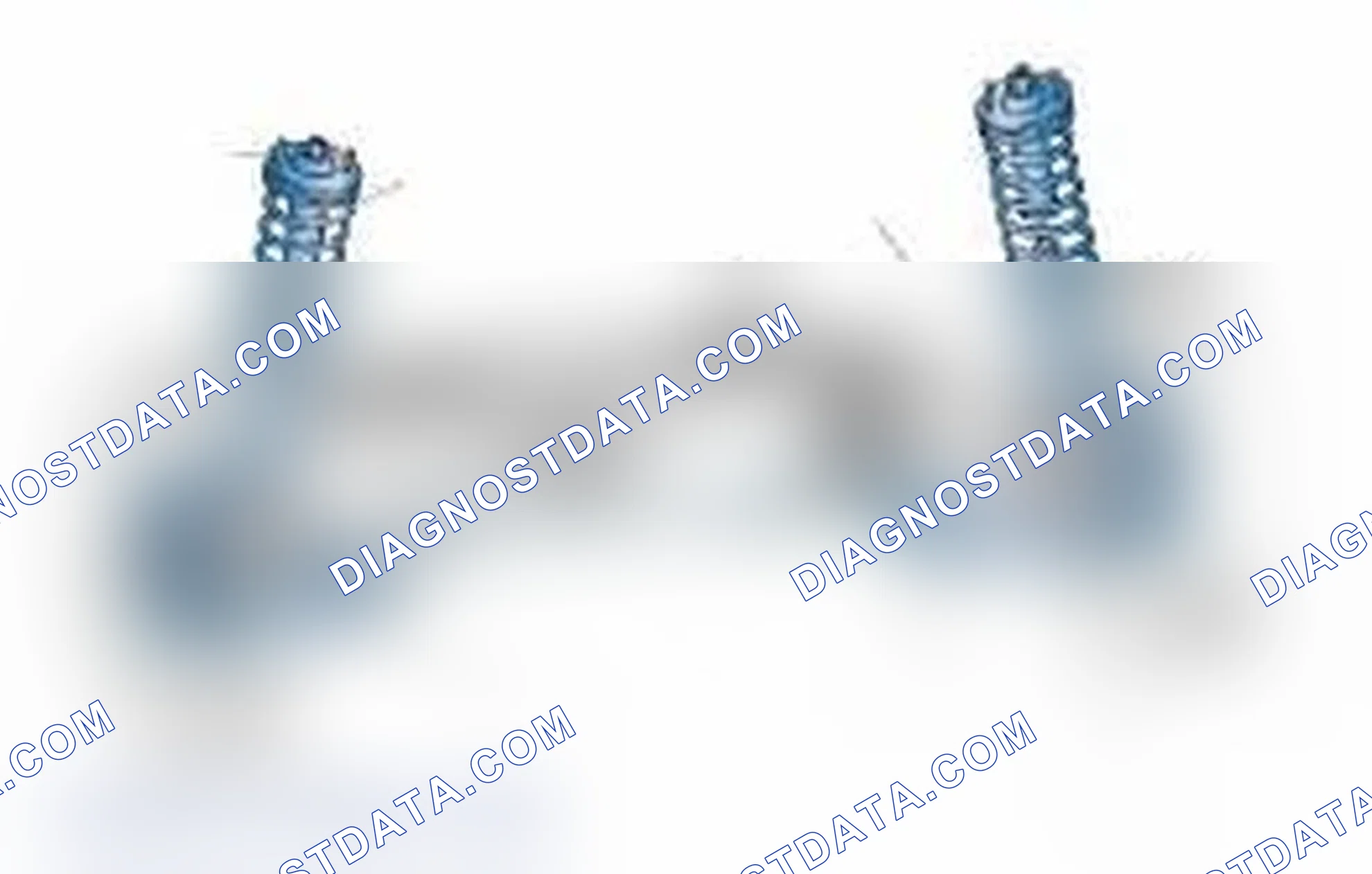 Scheme 25: Typical Front Suspension & Steering Components