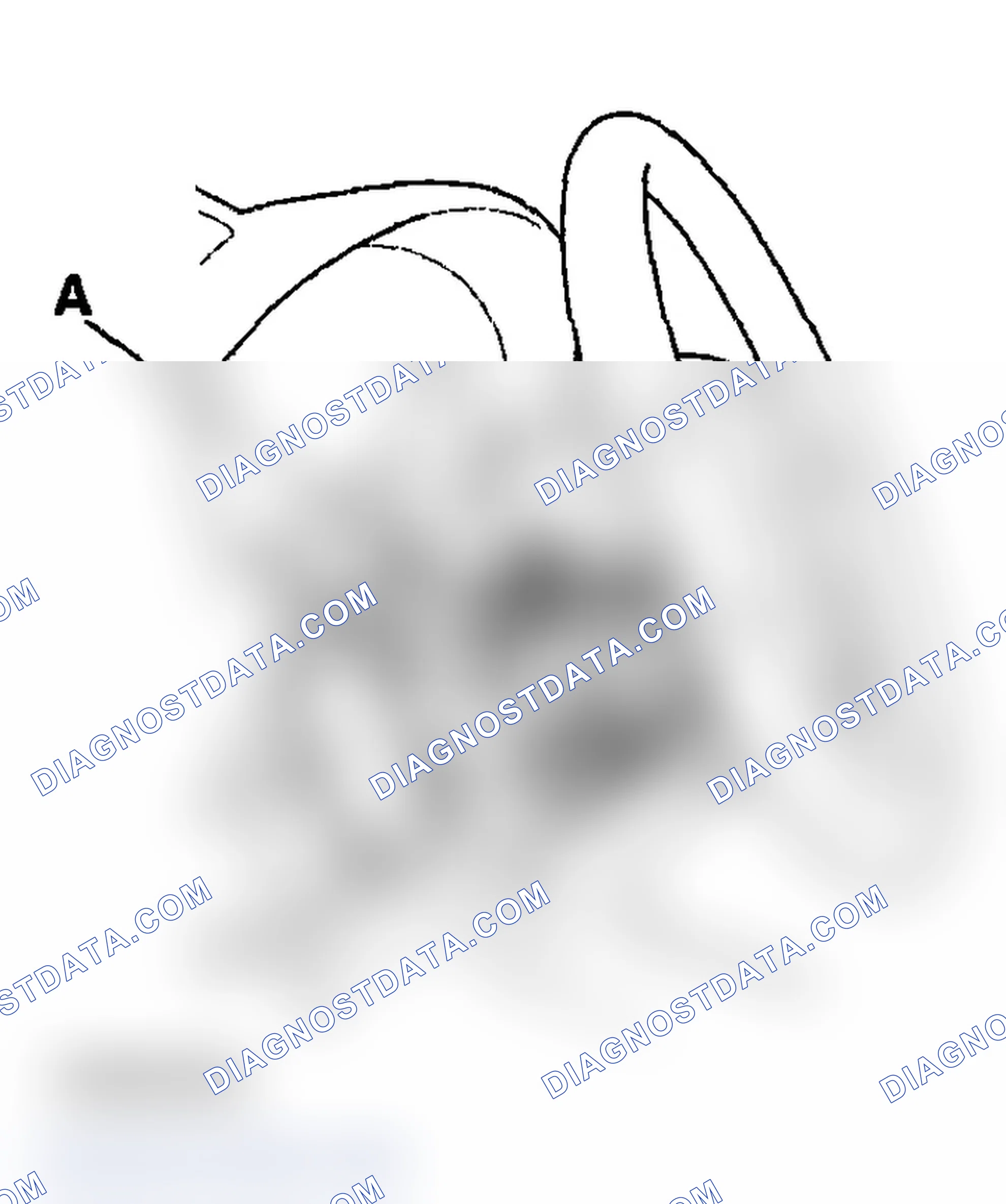 Scheme 59: Driver's Airbag