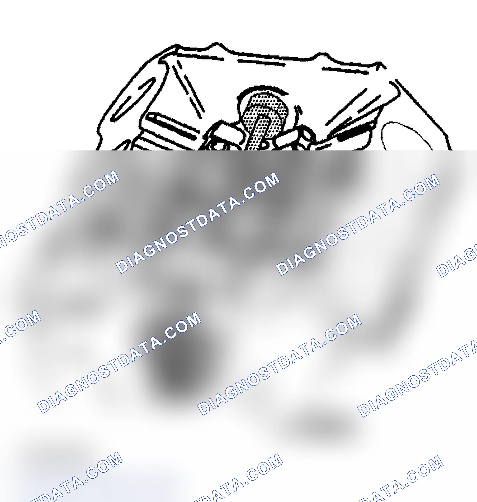 Scheme 554: Balance Shaft Bearing And/Or Bushing - Removal