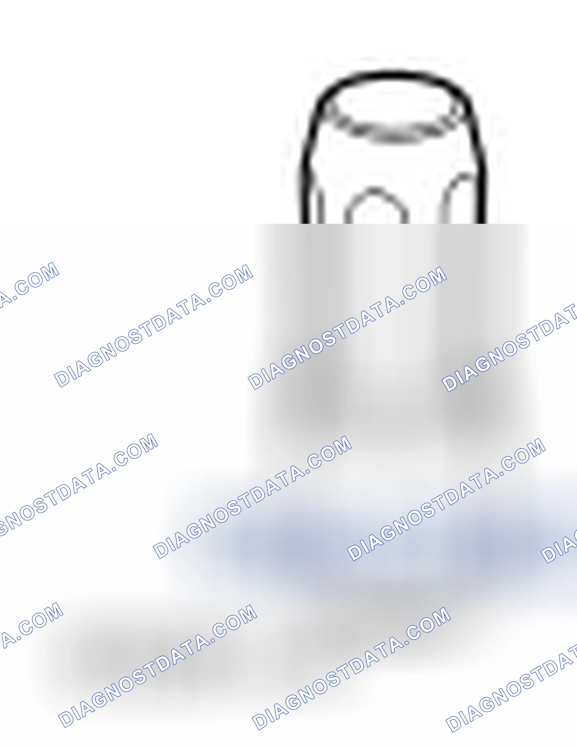 Scheme 11: Input Shaft Seal