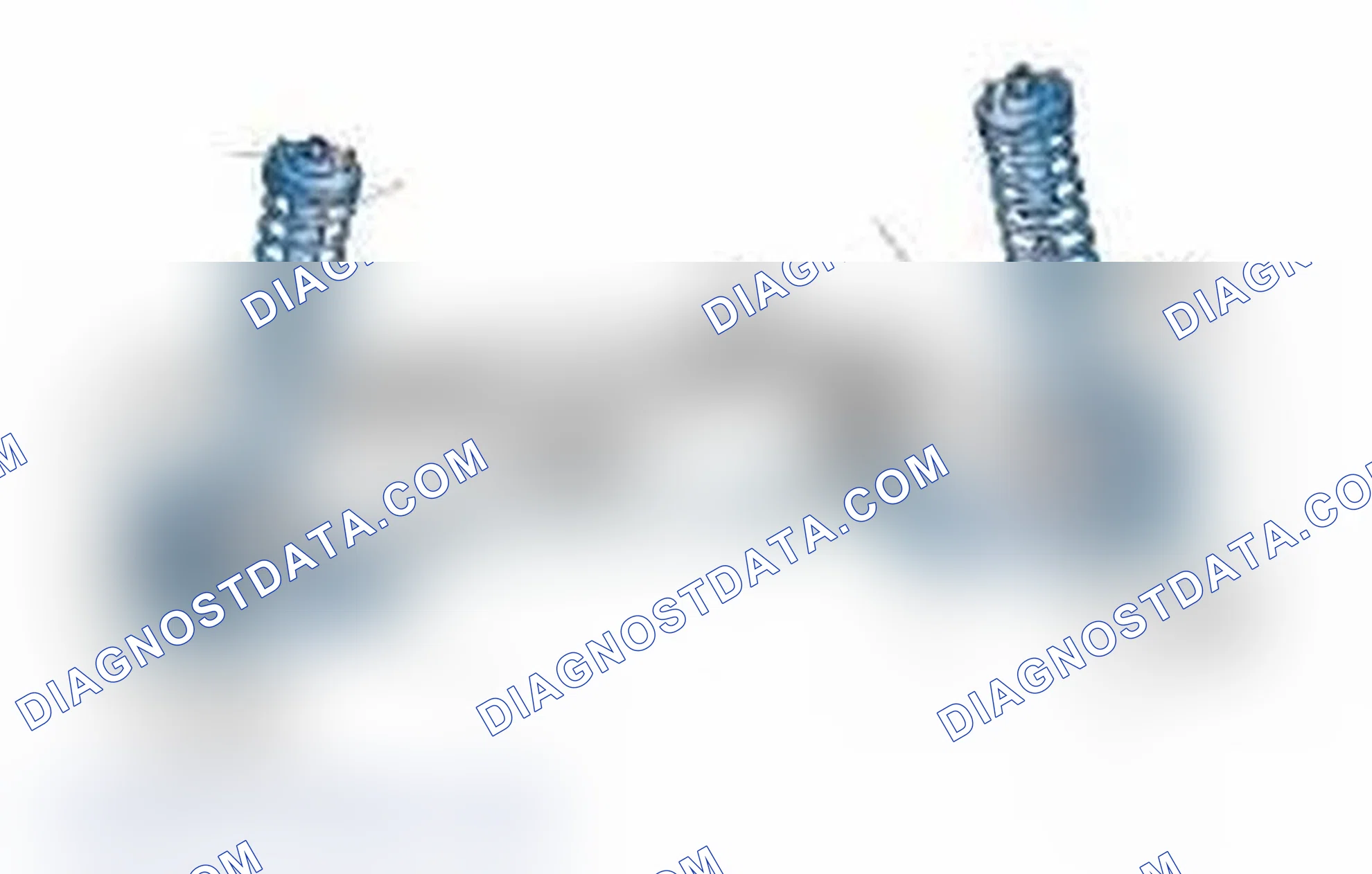 Scheme 25: Typical Front Suspension & Steering Components