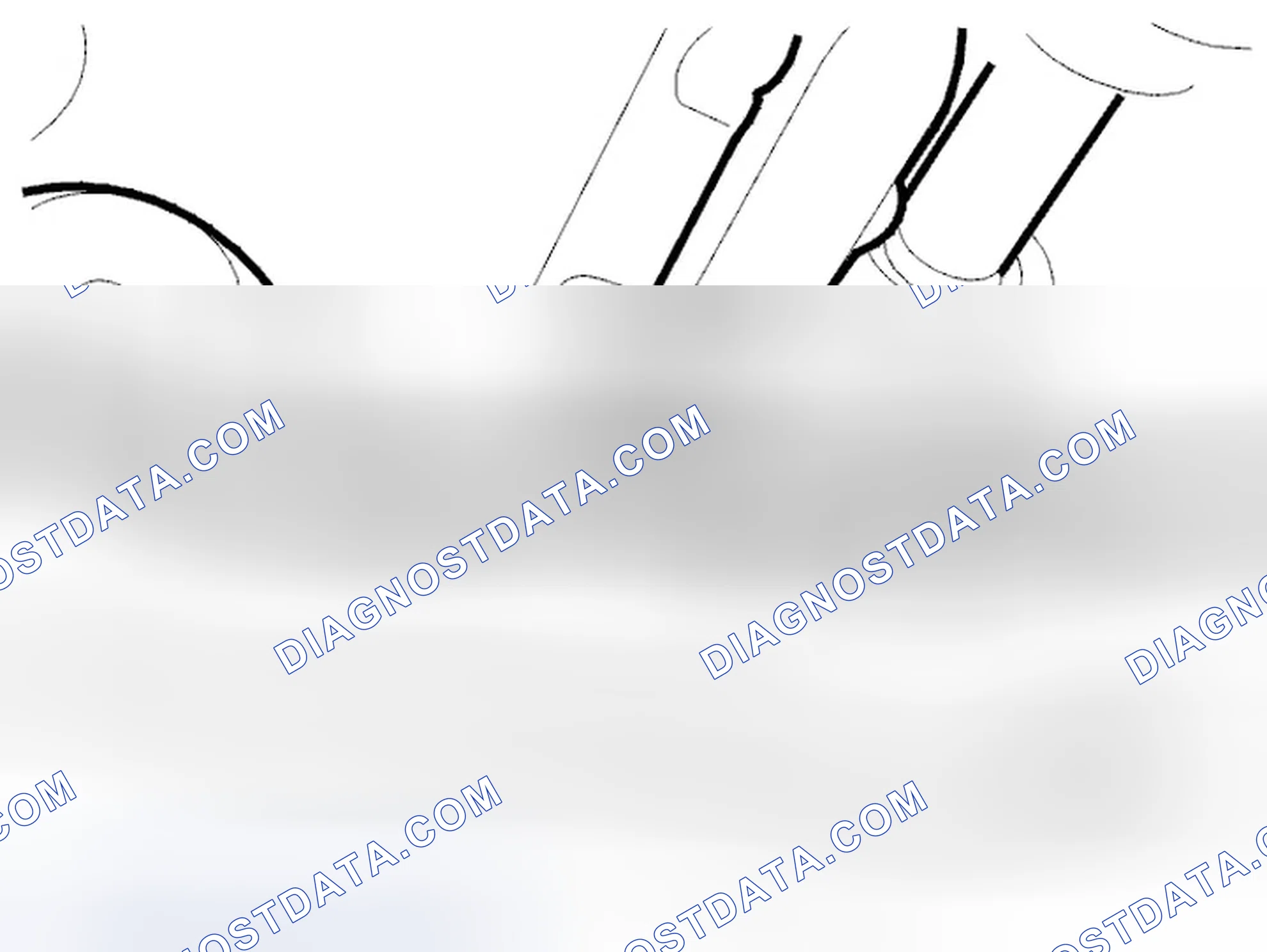 Scheme 102: Removing The Delivery Line For The Steering Gear