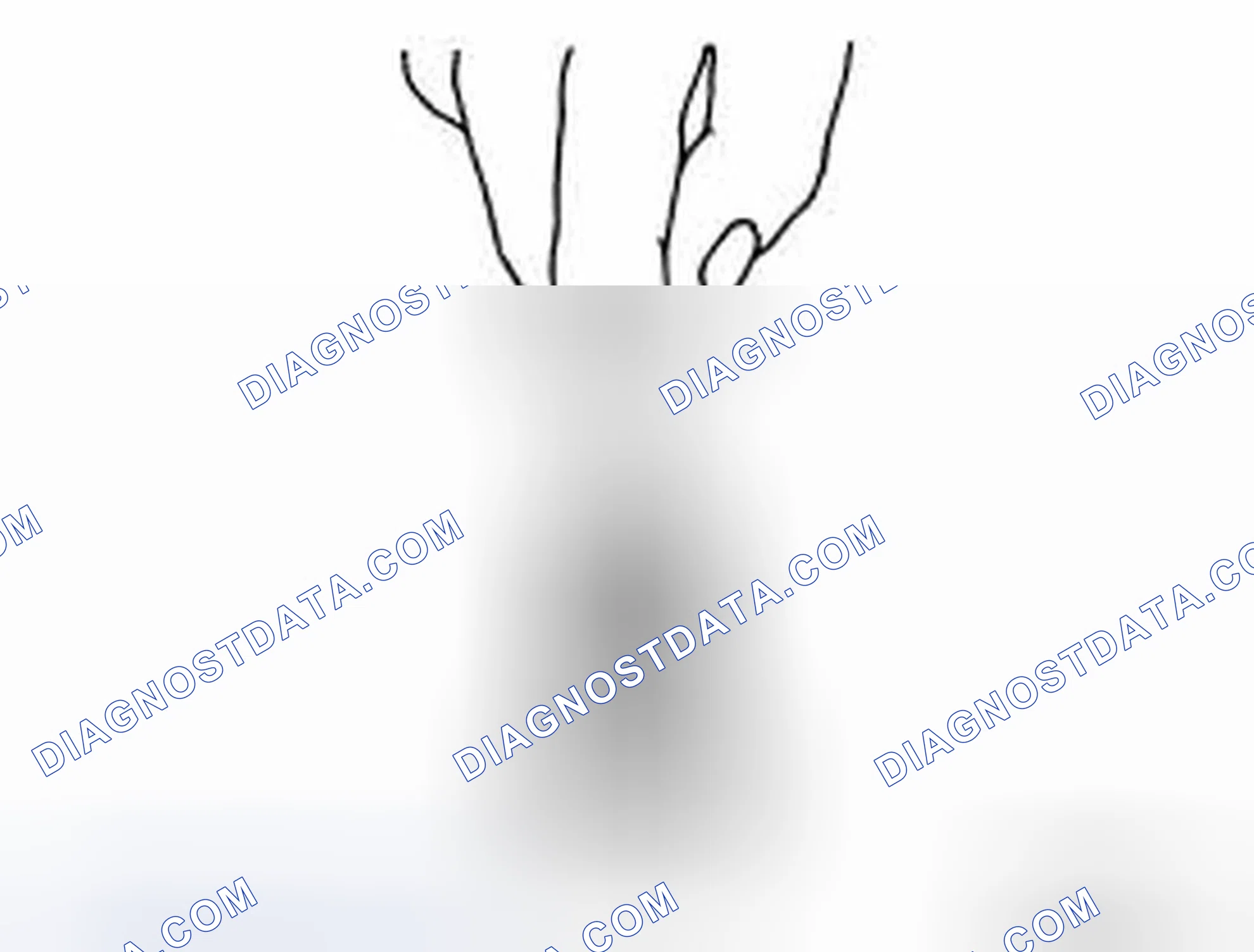 Scheme 274: OIL JET RELIEF VALVE
