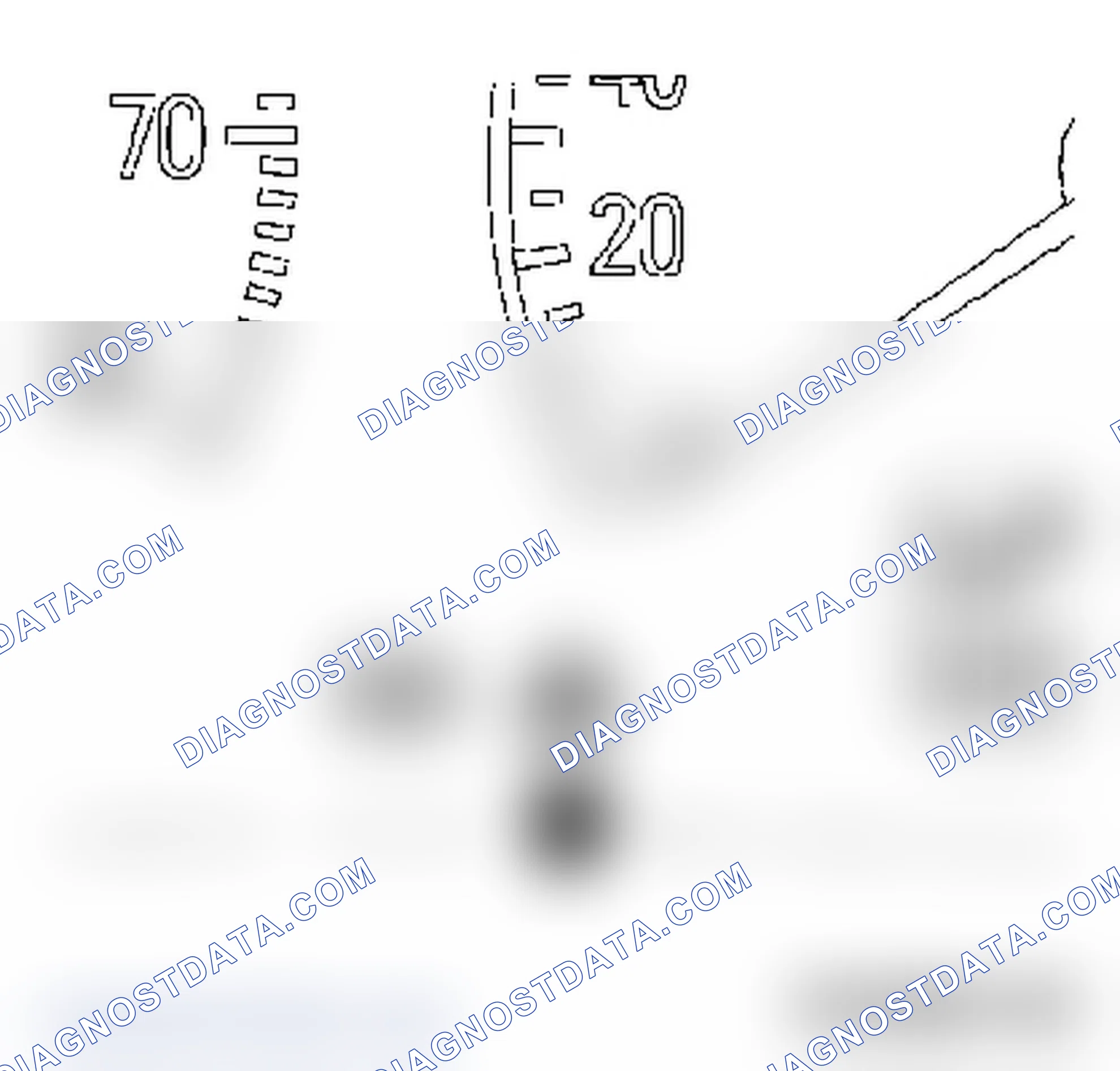 Electronic Stability Program (ESP)