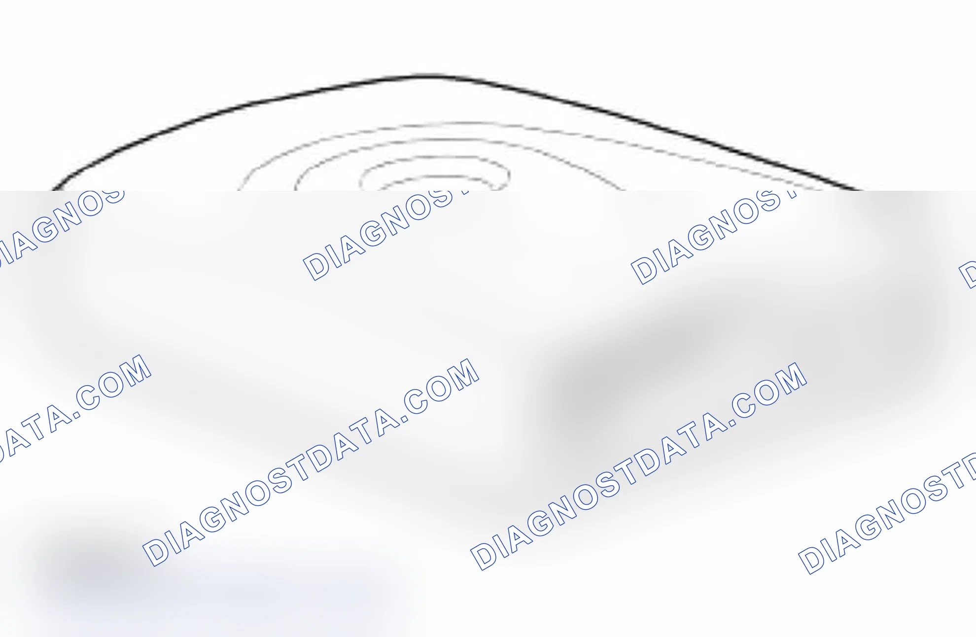 Scheme 17: Transceiver Module (TM)